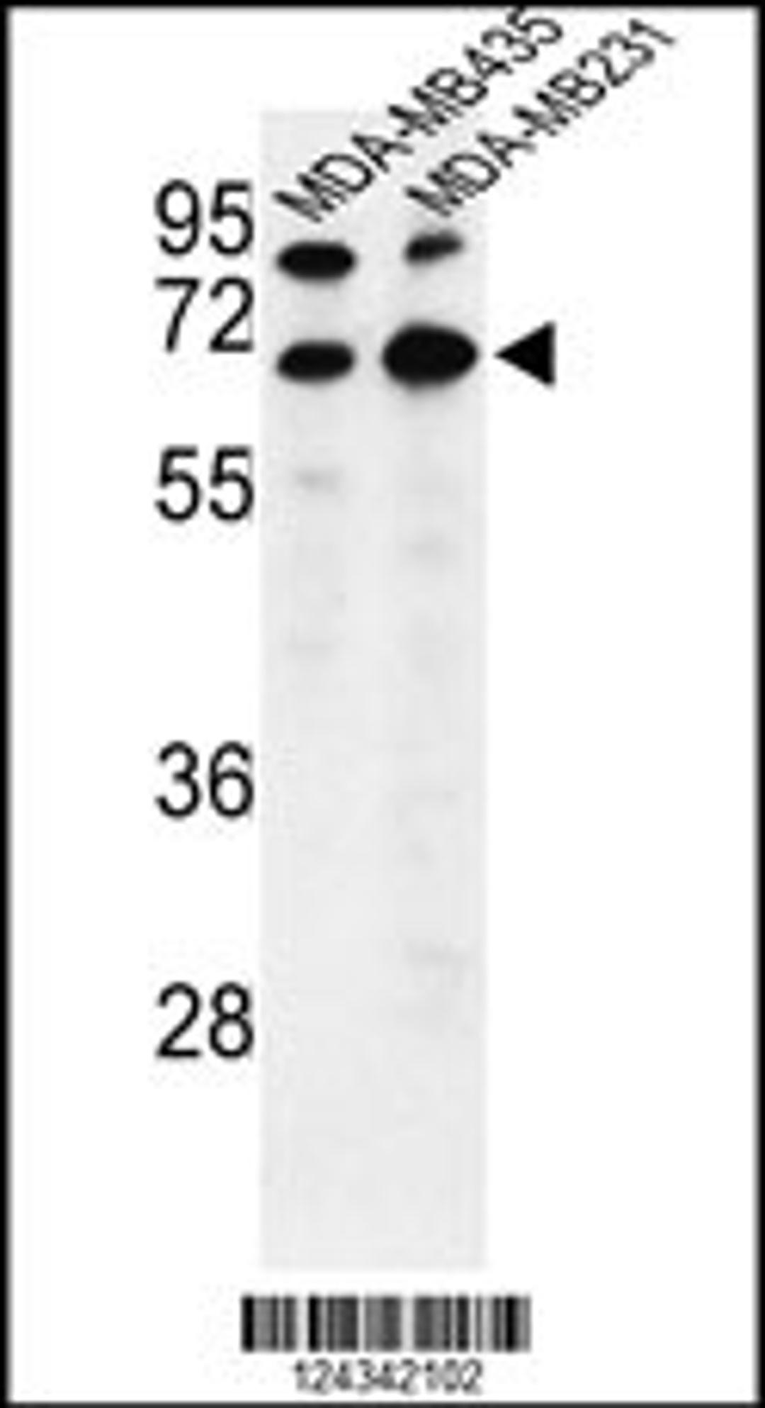 Western blot analysis of BEST2 Antibody in MDA-MB435,MDA-MB231 cell line lysates (35ug/lane)