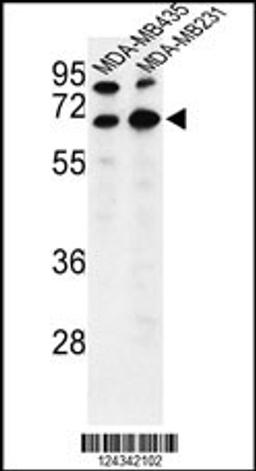 Western blot analysis of BEST2 Antibody in MDA-MB435,MDA-MB231 cell line lysates (35ug/lane)