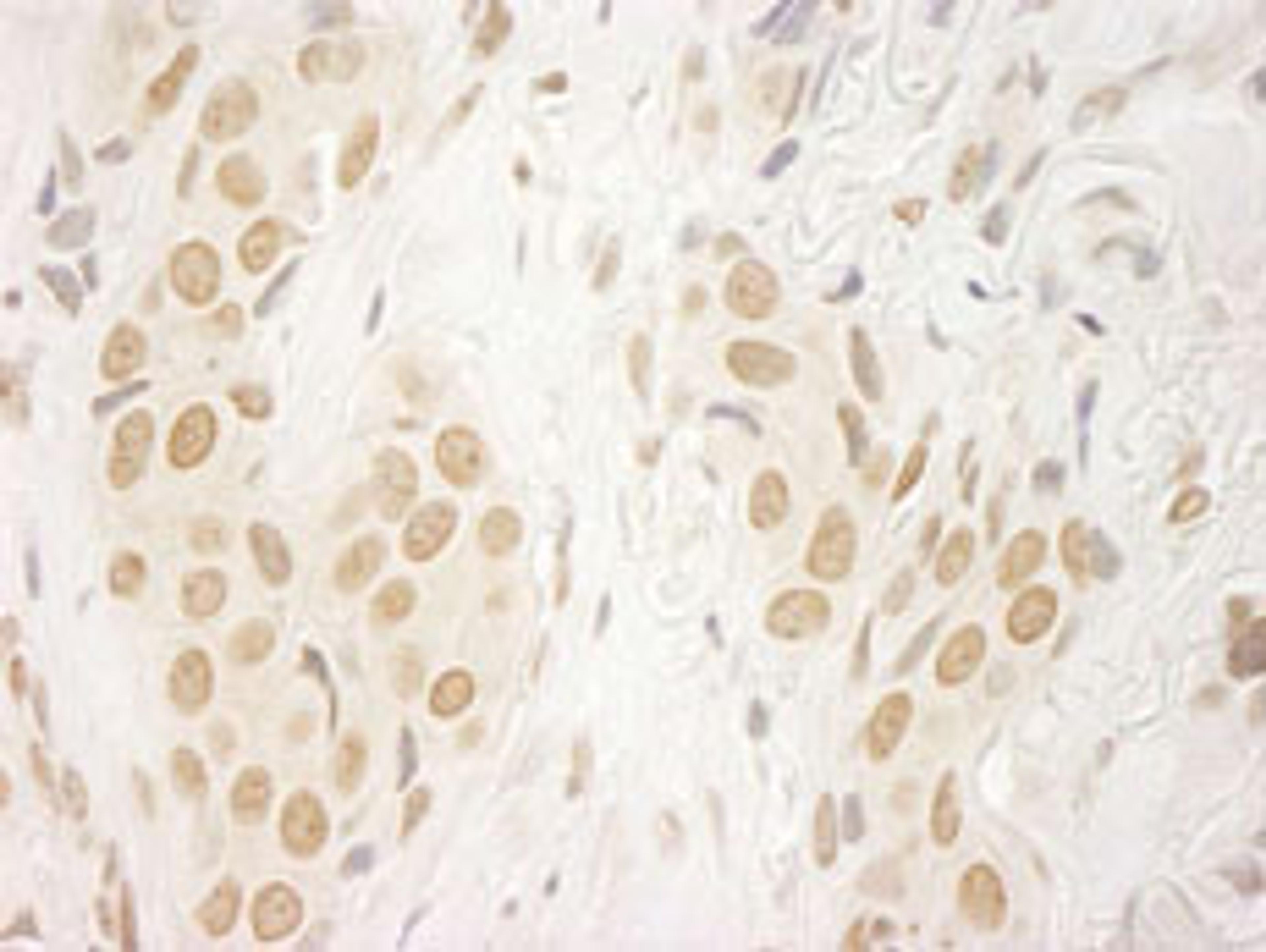 Detection of human FALZ/BPTF immunohistochemistry.