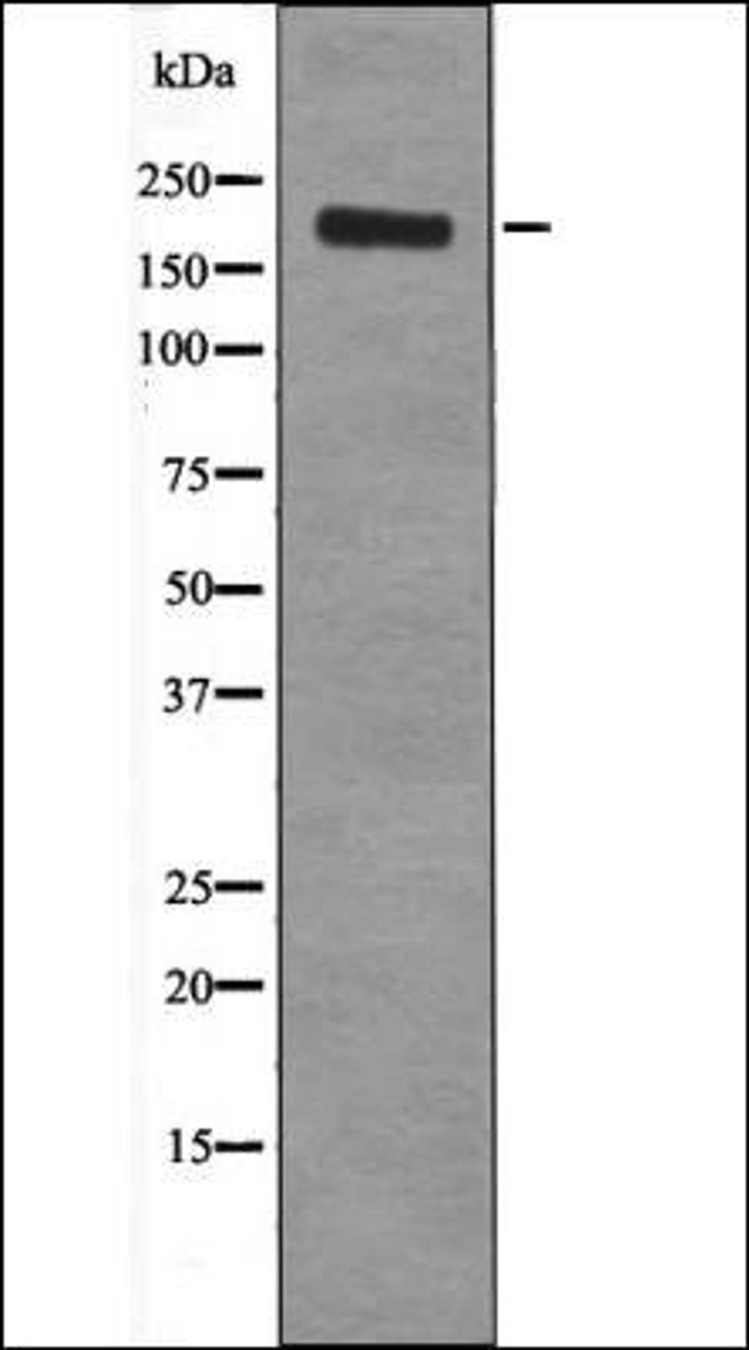 Western blot analysis of EGF treated HepG2 whole cell lysates using Ret -Phospho-Tyr1096- antibody