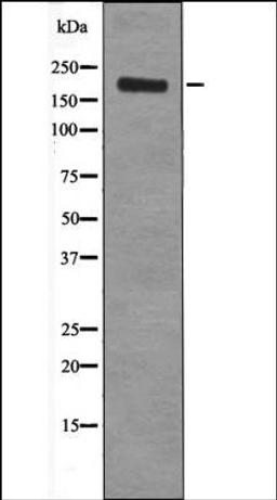 Western blot analysis of EGF treated HepG2 whole cell lysates using Ret -Phospho-Tyr1096- antibody