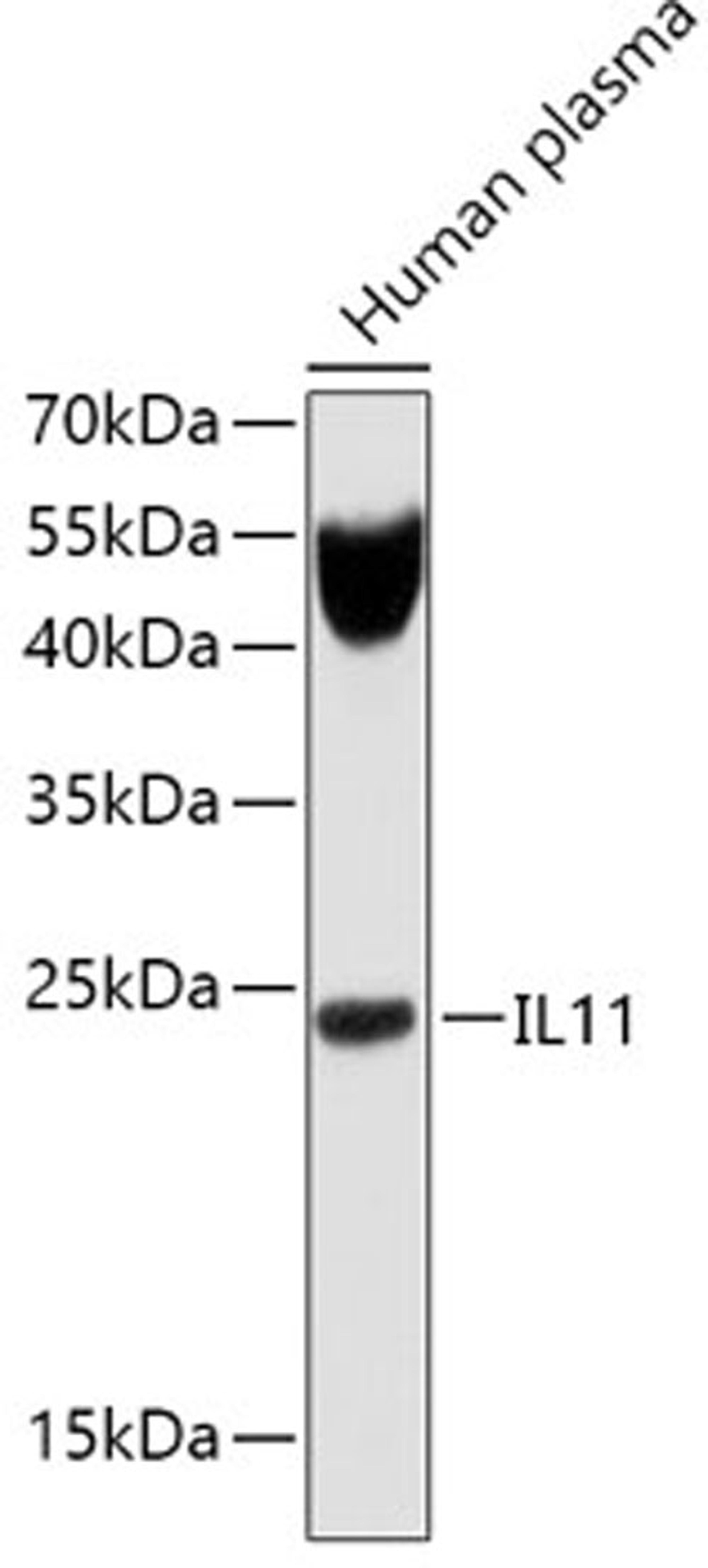 Western blot - IL11 antibody (A1902)