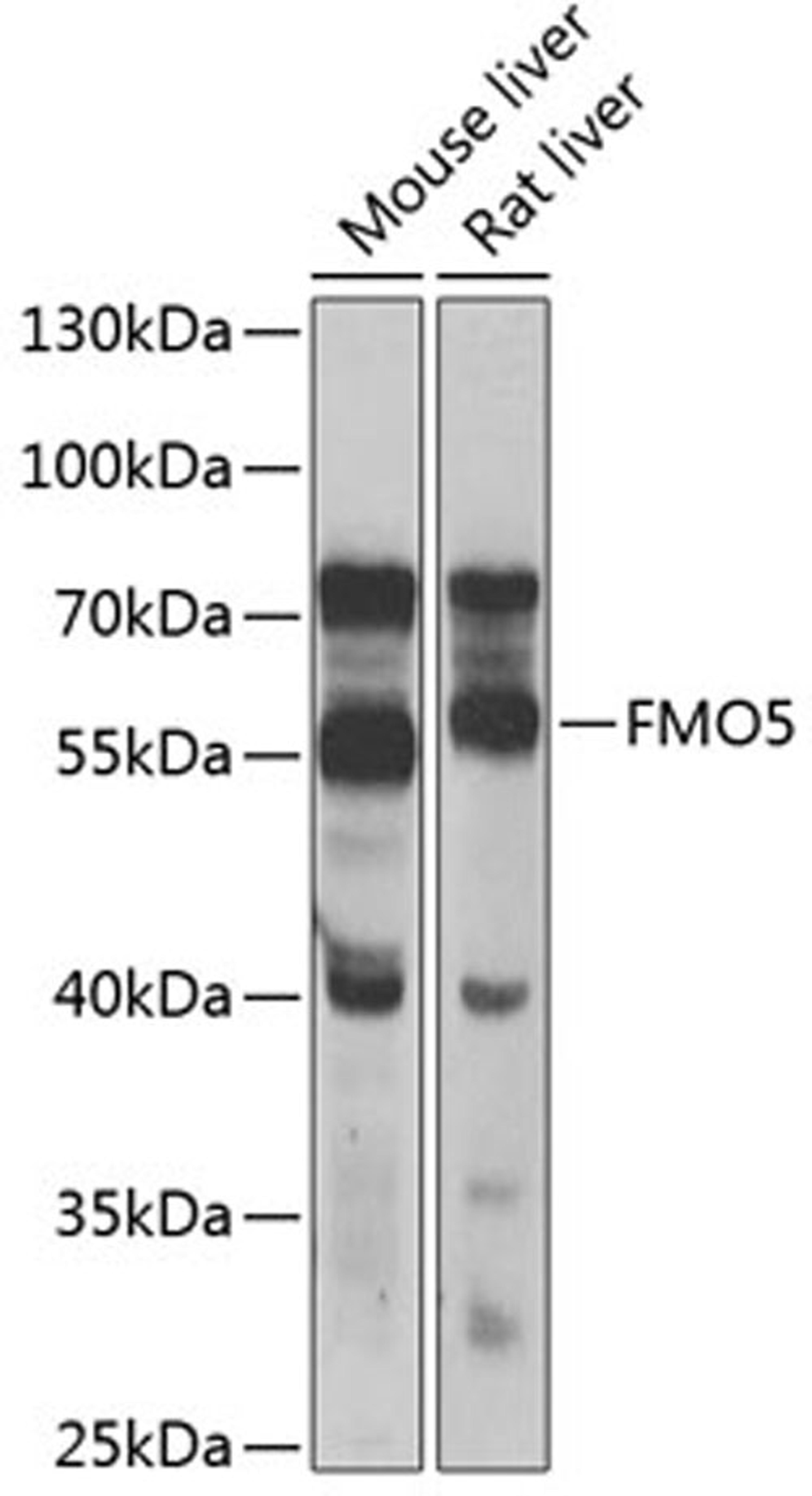 Western blot - FMO5 antibody (A7673)