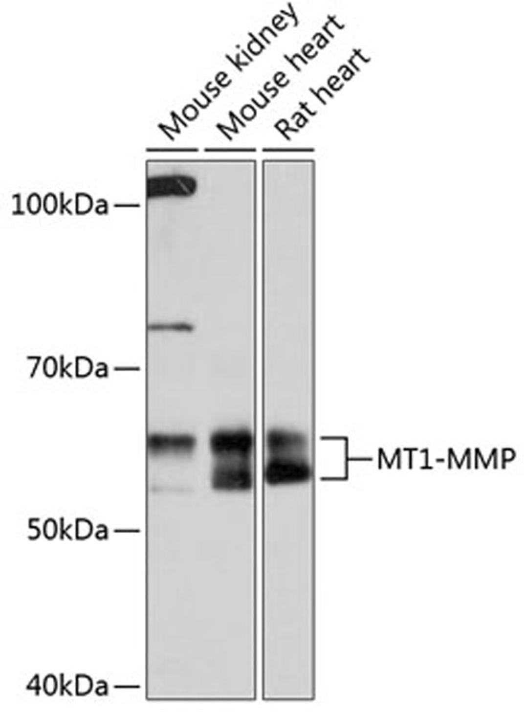 Western blot - MT1-MMP Rabbit mAb (A0067)