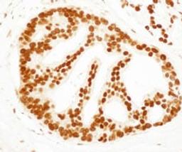 Detection of human SET by immunohistochemistry.