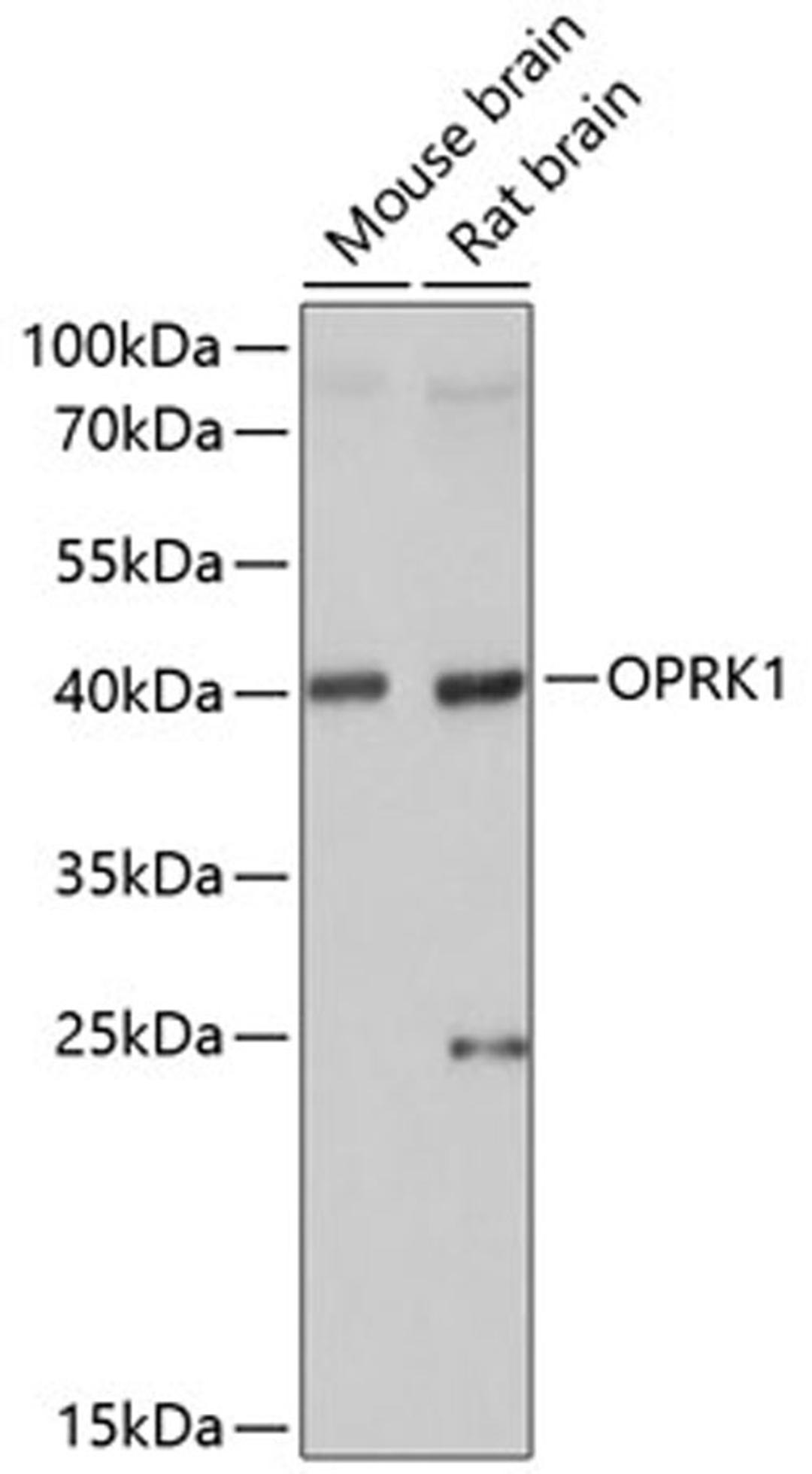 Western blot - OPRK1 antibody (A14035)