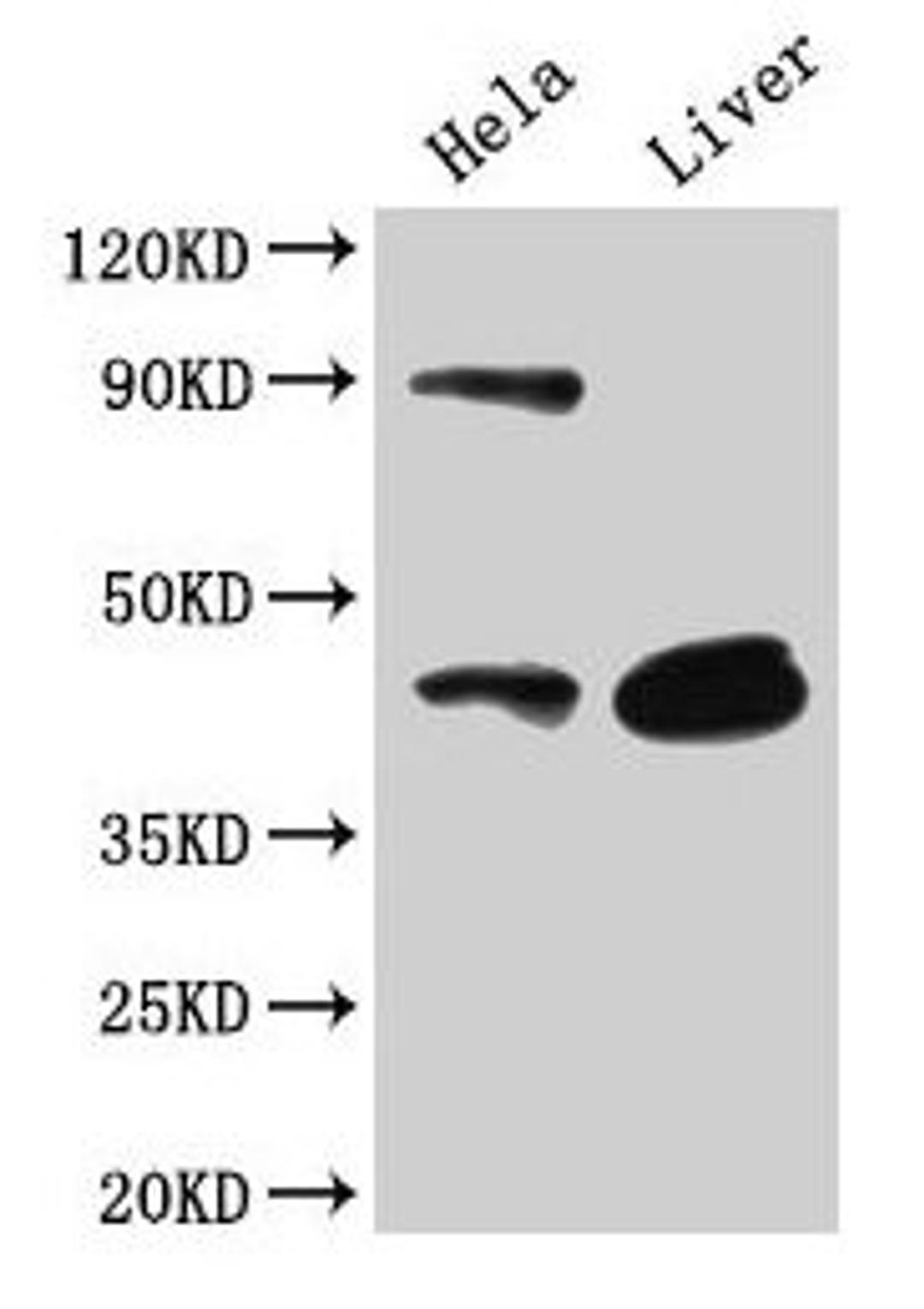 Western Blot. Positive WB detected in: Hela whole cell lysate, Mouse liver tissue. All lanes: CD46 antibody at 3µg/ml. Secondary. Goat polyclonal to rabbit IgG at 1/50000 dilution. Predicted band size: 44, 45, 43, 41, 42, 40, 37 kDa. Observed band size: 44 kDa
