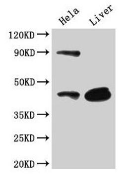 Western Blot. Positive WB detected in: Hela whole cell lysate, Mouse liver tissue. All lanes: CD46 antibody at 3µg/ml. Secondary. Goat polyclonal to rabbit IgG at 1/50000 dilution. Predicted band size: 44, 45, 43, 41, 42, 40, 37 kDa. Observed band size: 44 kDa
