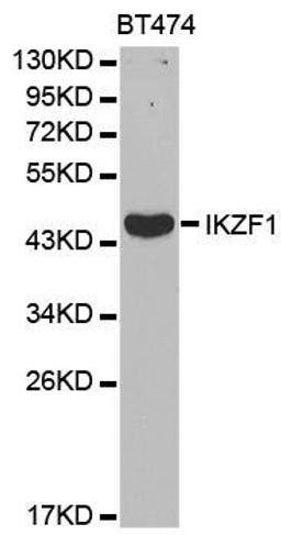 Western blot analysis of extracts of BT474 cell lines using IKZF1 antibody