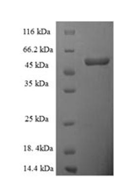(Tris-Glycine gel) Discontinuous SDS-PAGE (reduced) with 5% enrichment gel and 15% separation gel.