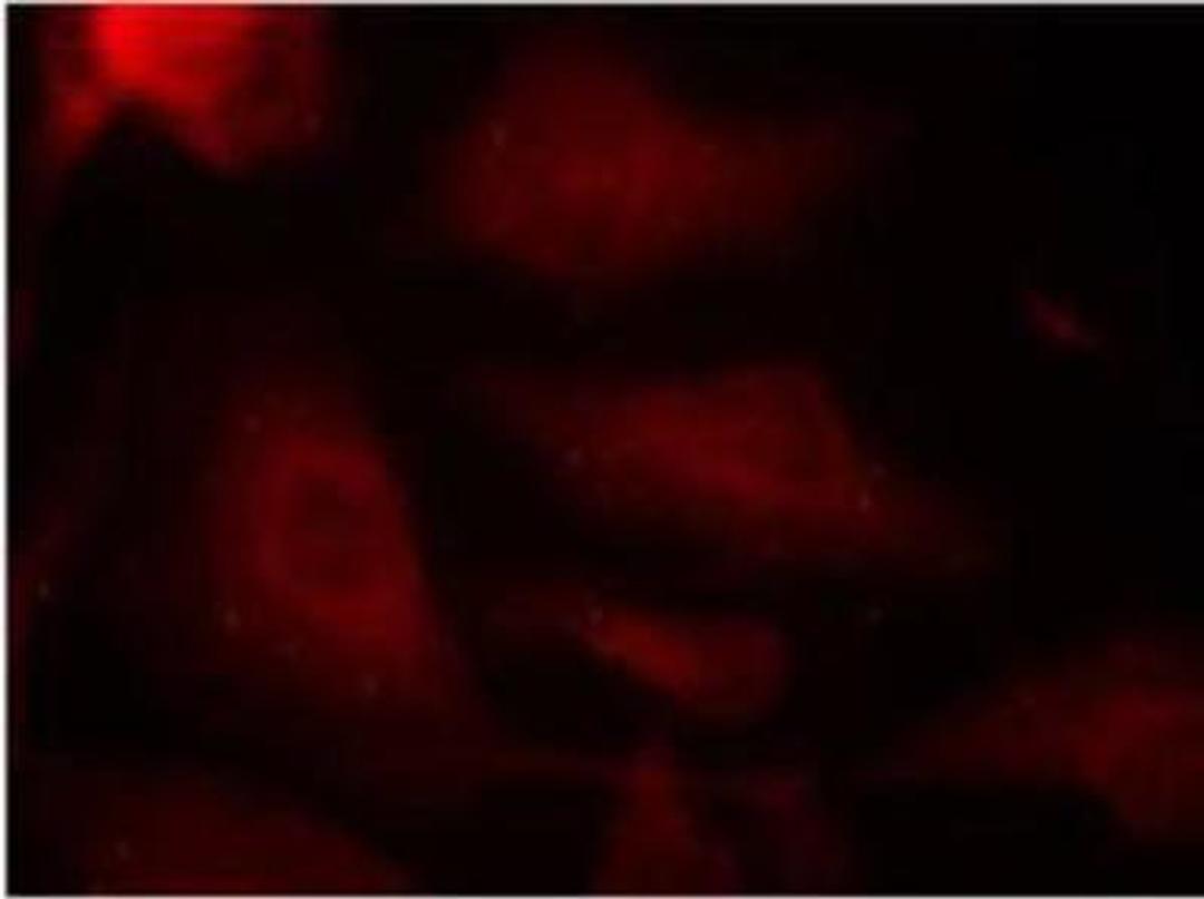 Immunocytochemistry/Immunofluorescence: Tau [p Ser404] Antibody [NB100-82244] - Staining of methanol-fixed Hela cells.