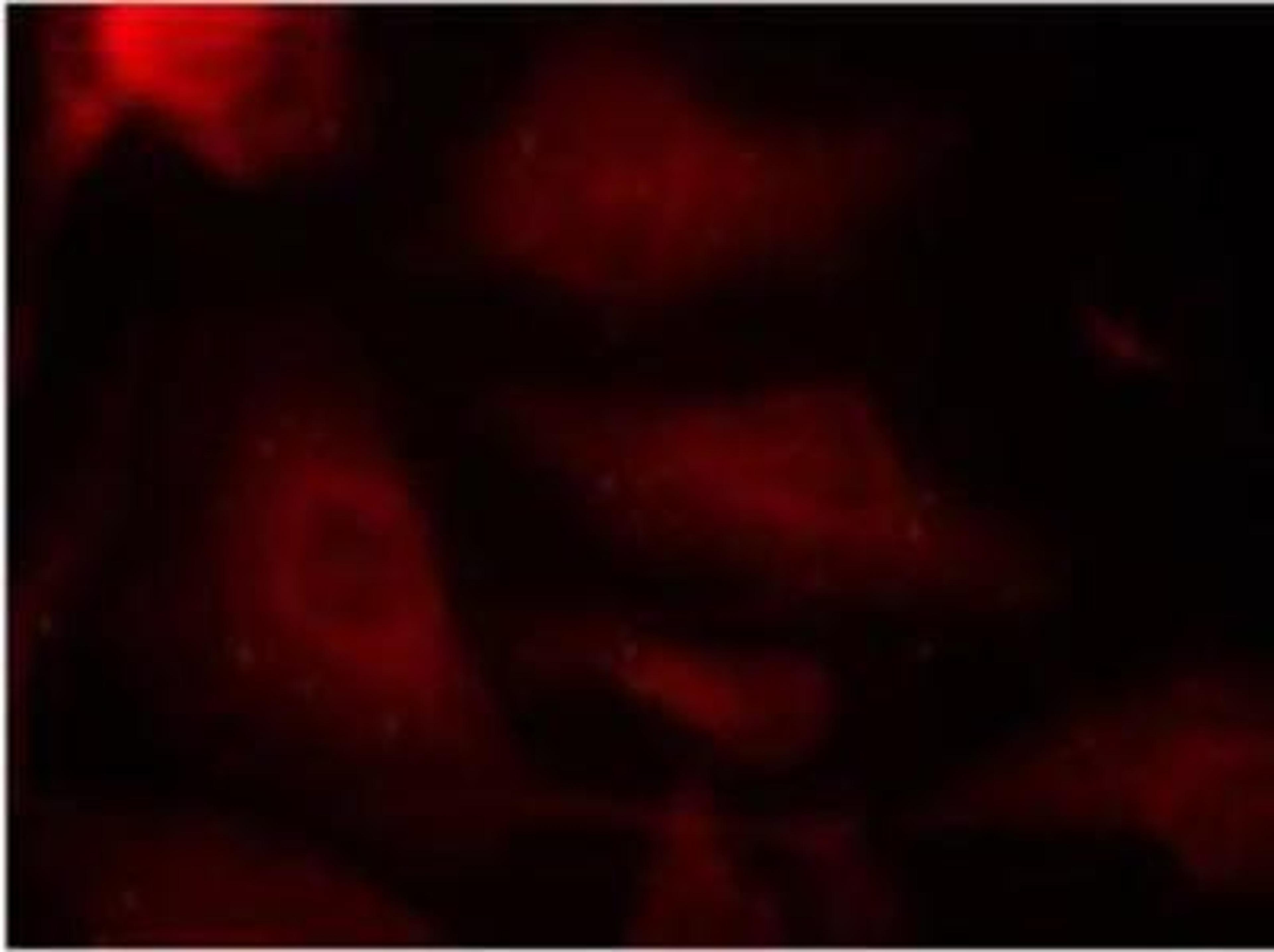 Immunocytochemistry/Immunofluorescence: Tau [p Ser404] Antibody [NB100-82244] - Staining of methanol-fixed Hela cells.