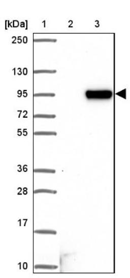 Western Blot: LOC81691 exonuclease NEF-sp Antibody [NBP1-92075] - Lane 1: Marker [kDa] 250, 130, 95, 72, 55, 36, 28, 17, 10<br/>Lane 2: Negative control (vector only transfected HEK293T lysate)<br/>Lane 3: Over-expression lysate (Co-expressed with a C-terminal myc-DDK tag (~3.1 kDa) in mammalian HEK293T cells, LY403099)