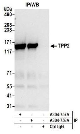 Detection of human TPP2 by western blot of immunoprecipitates.