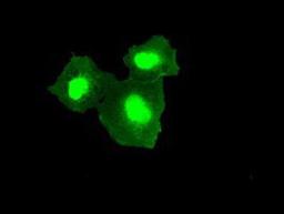 Immunocytochemistry/Immunofluorescence: TMEM100 Antibody (10G3) [NBP1-48024] Staining of COS7 cells transiently transfected by pCMV6-ENTRY TMEM100.