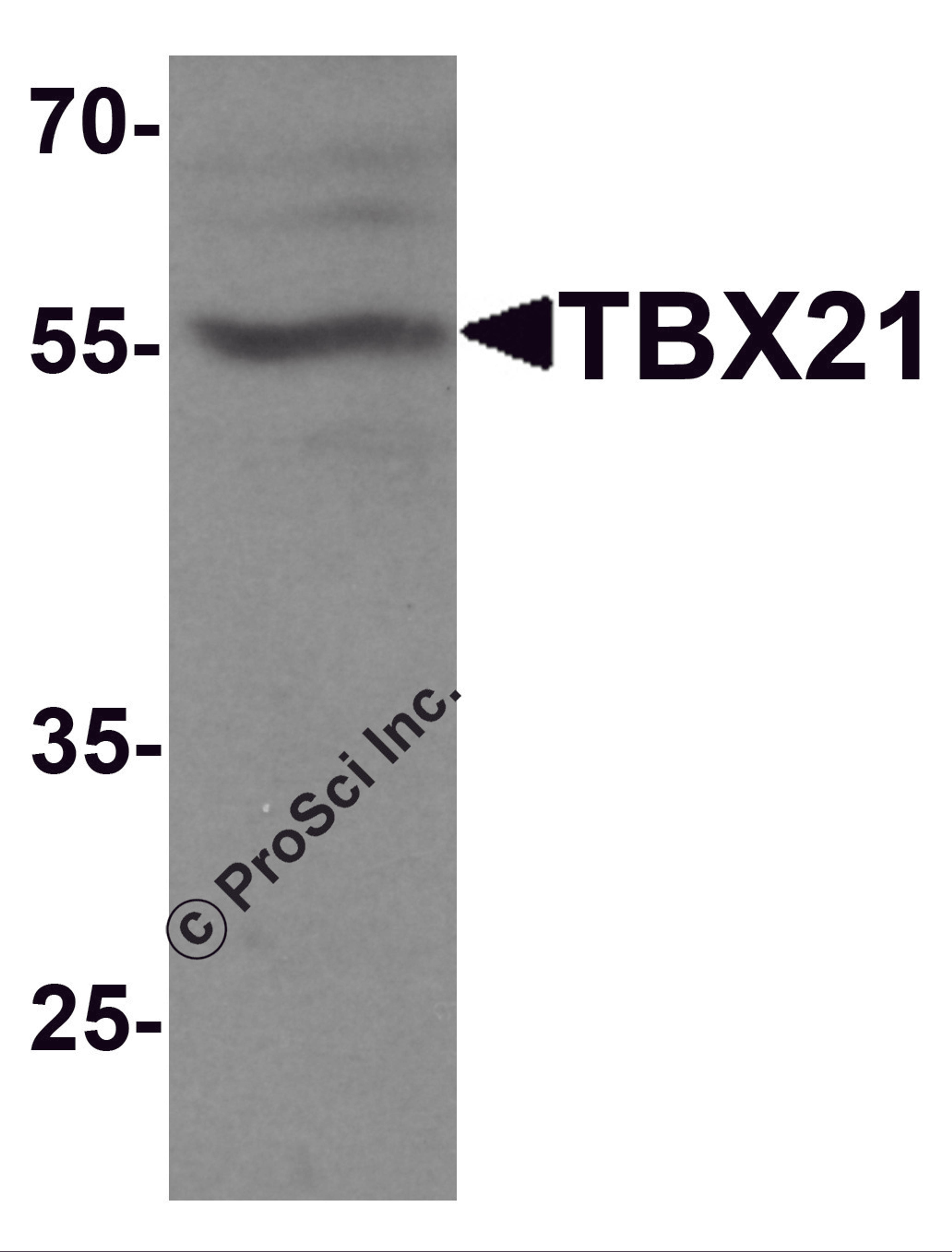 Western blot analysis of TBX21 in 293 cell lysate with TBX21 antibody at 1 μg/ml.