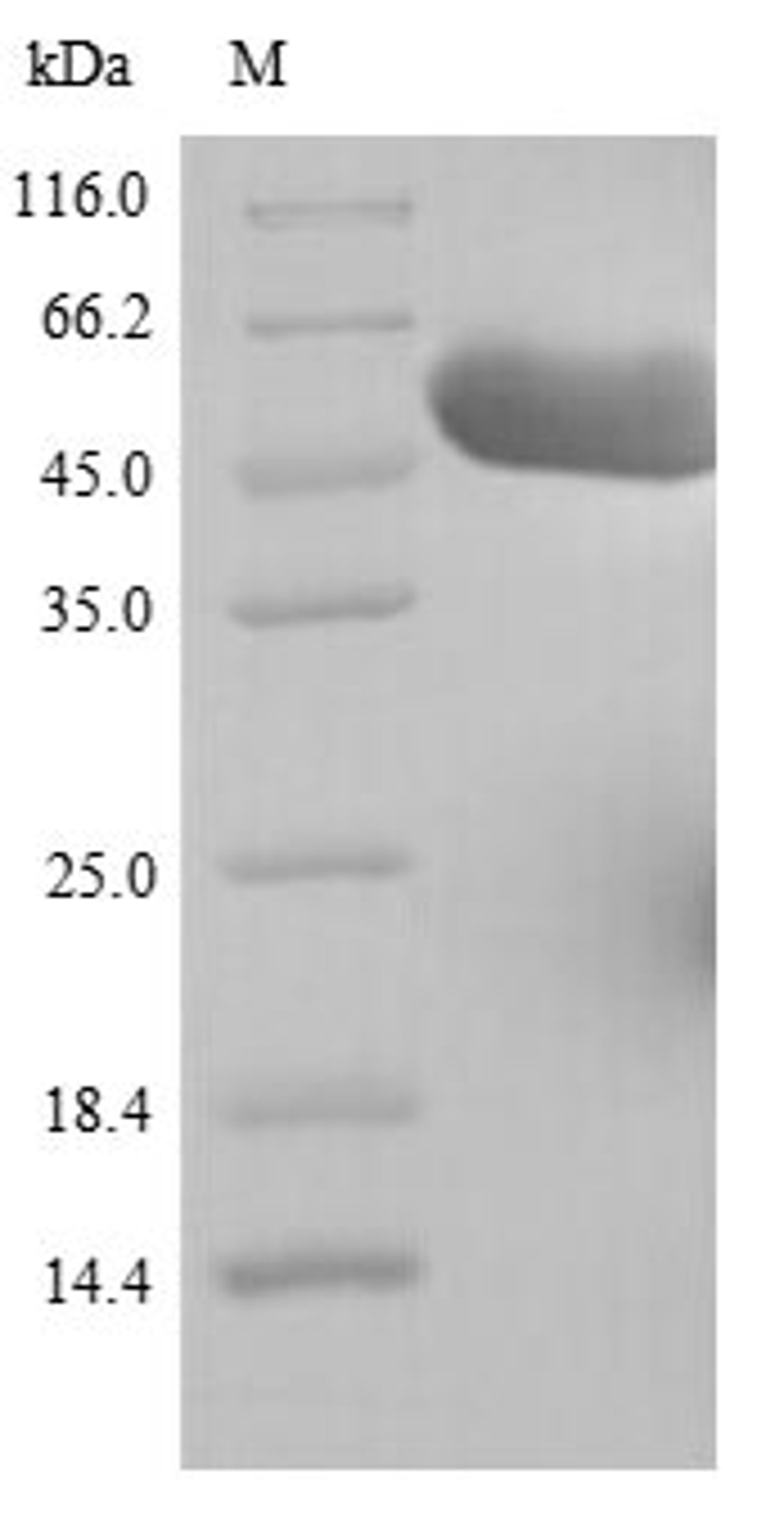 (Tris-Glycine gel) Discontinuous SDS-PAGE (reduced) with 5% enrichment gel and 15% separation gel.