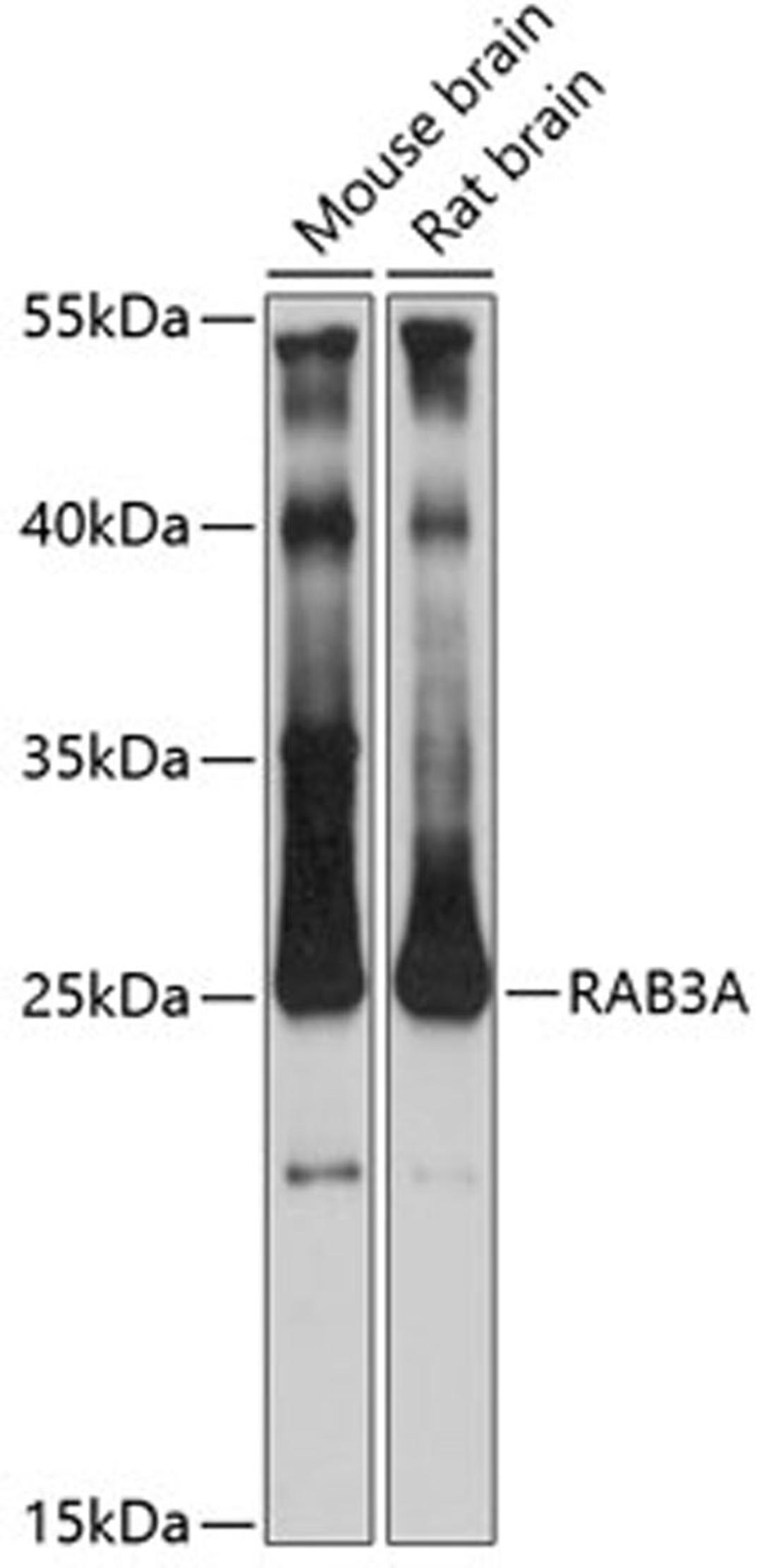 Western blot - RAB3A antibody (A5379)