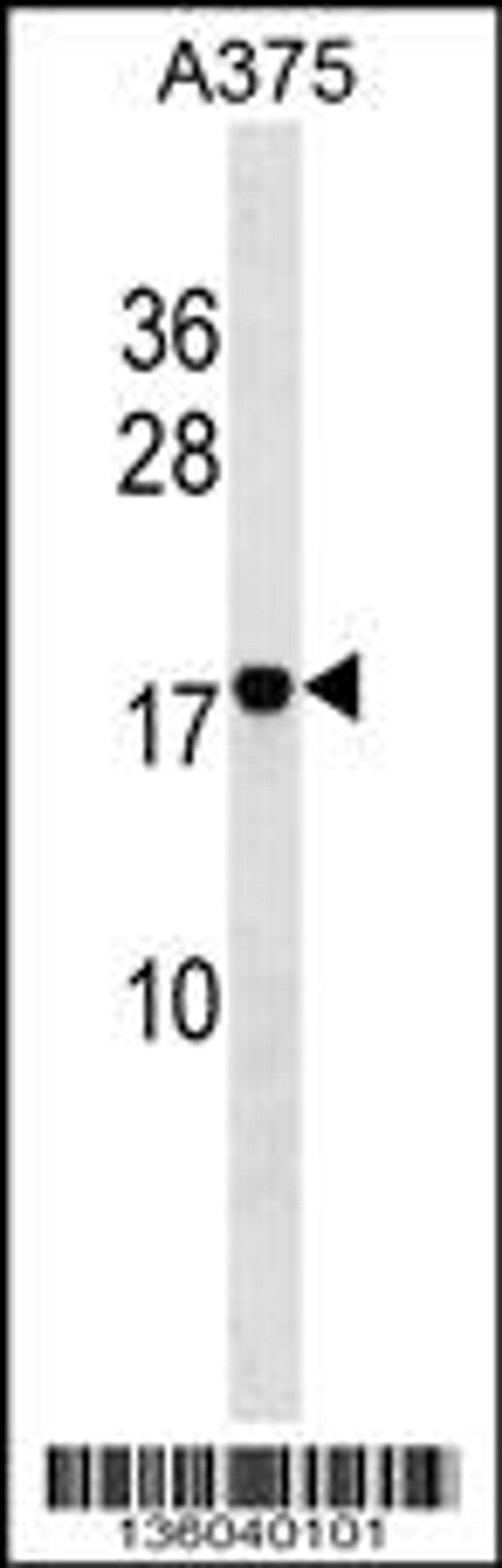 Western blot analysis in A375 cell line lysates (35ug/lane).