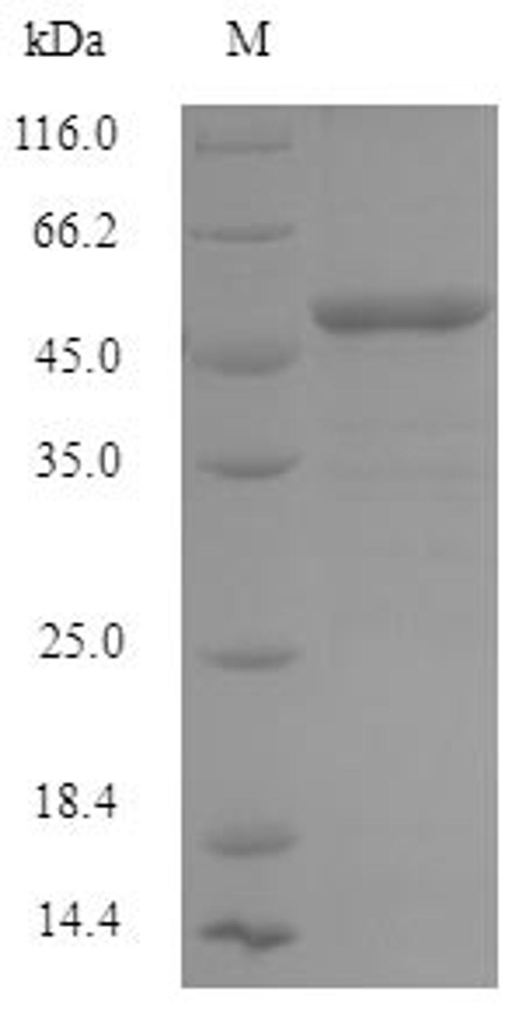 (Tris-Glycine gel) Discontinuous SDS-PAGE (reduced) with 5% enrichment gel and 15% separation gel.