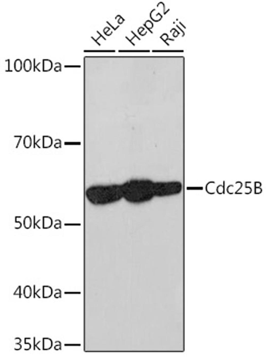 Western blot - Cdc25B Rabbit mAb (A9758)