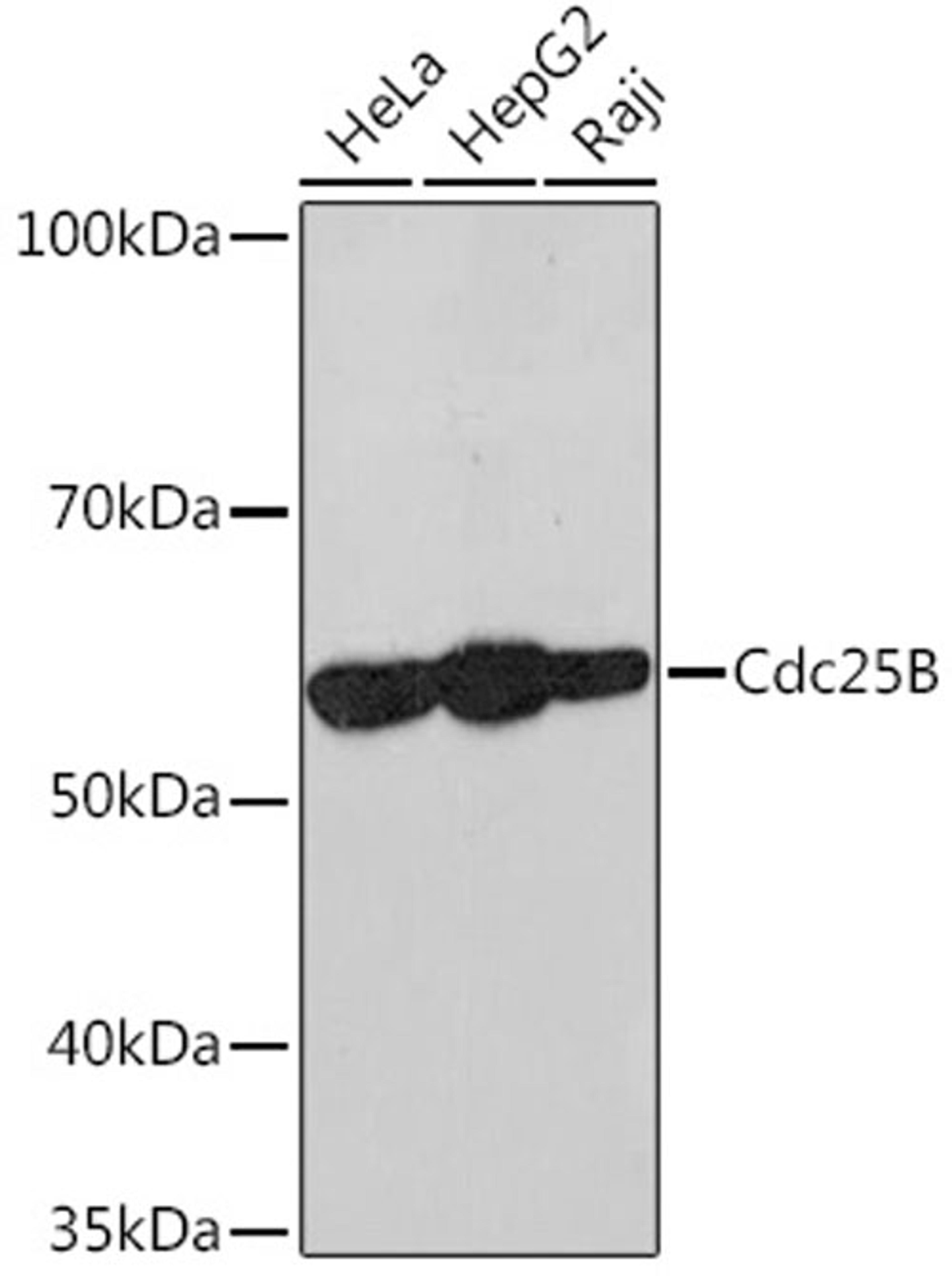 Western blot - Cdc25B Rabbit mAb (A9758)