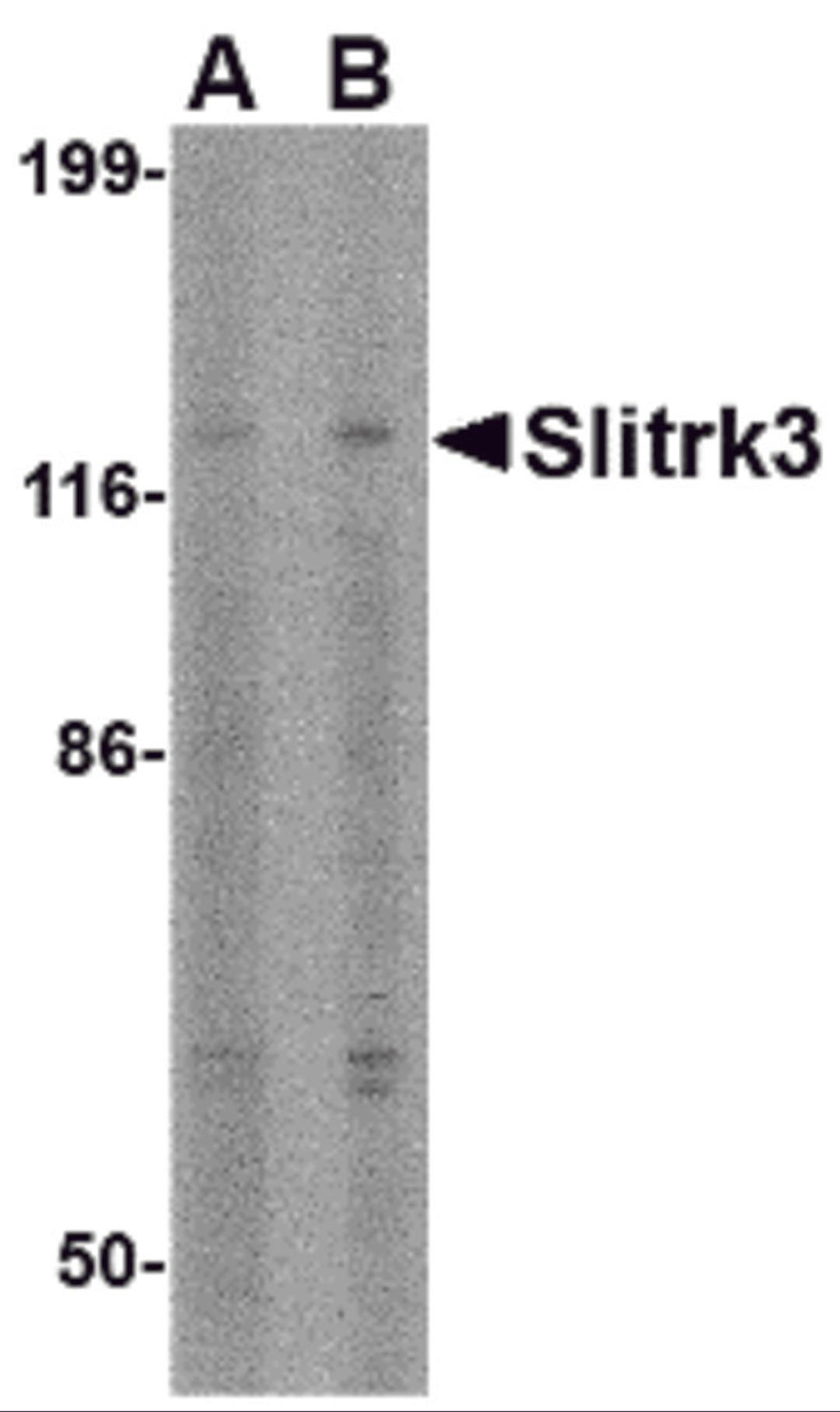 Western blot analysis of Slitrk3 in SK-N-SH cell lysate with Slitrk3 antibody at (A) 0.5 and (B) 1 &#956;g/mL.