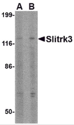 Western blot analysis of Slitrk3 in SK-N-SH cell lysate with Slitrk3 antibody at (A) 0.5 and (B) 1 &#956;g/mL.