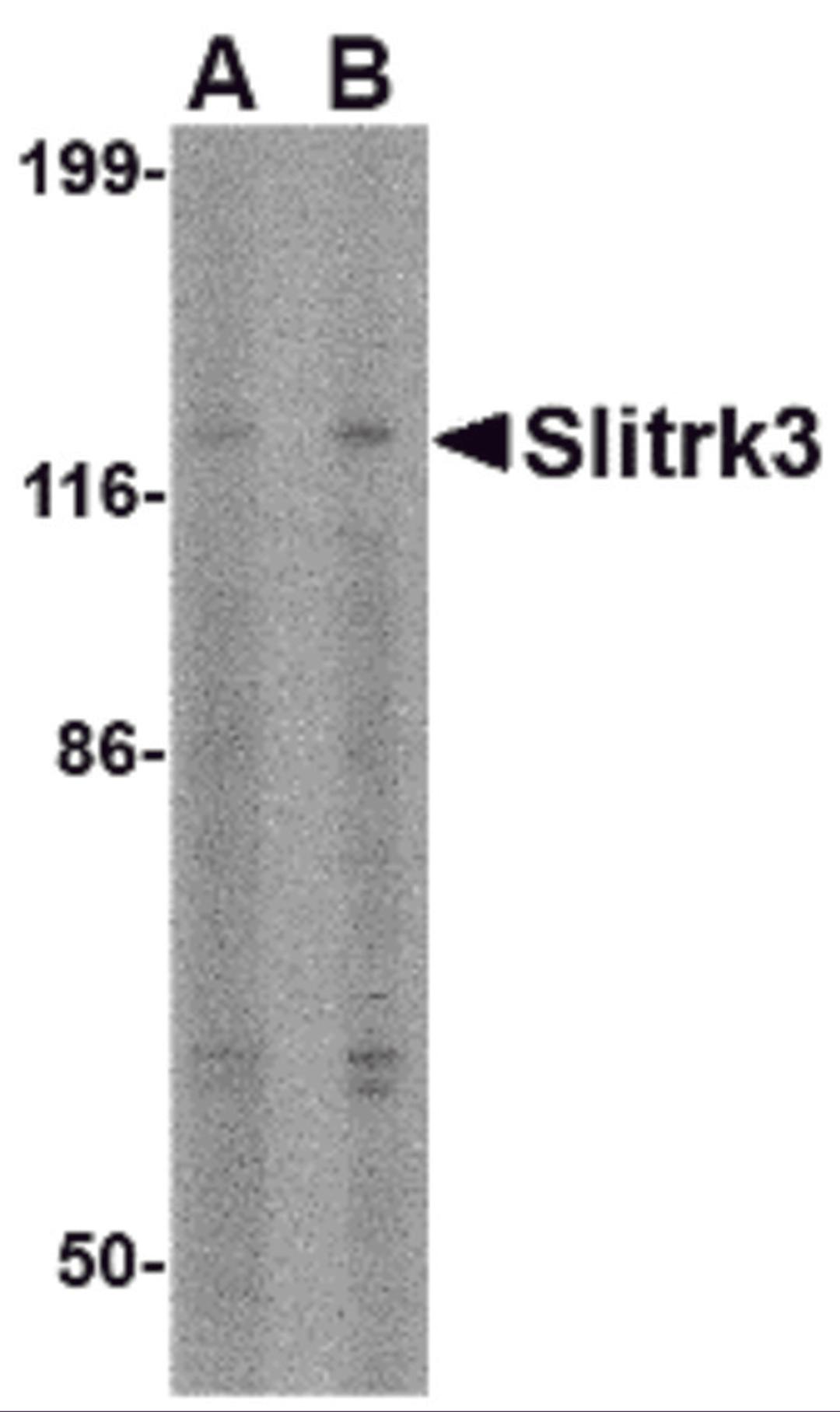 Western blot analysis of Slitrk3 in SK-N-SH cell lysate with Slitrk3 antibody at (A) 0.5 and (B) 1 μg/mL.