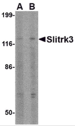 Western blot analysis of Slitrk3 in SK-N-SH cell lysate with Slitrk3 antibody at (A) 0.5 and (B) 1 μg/mL.