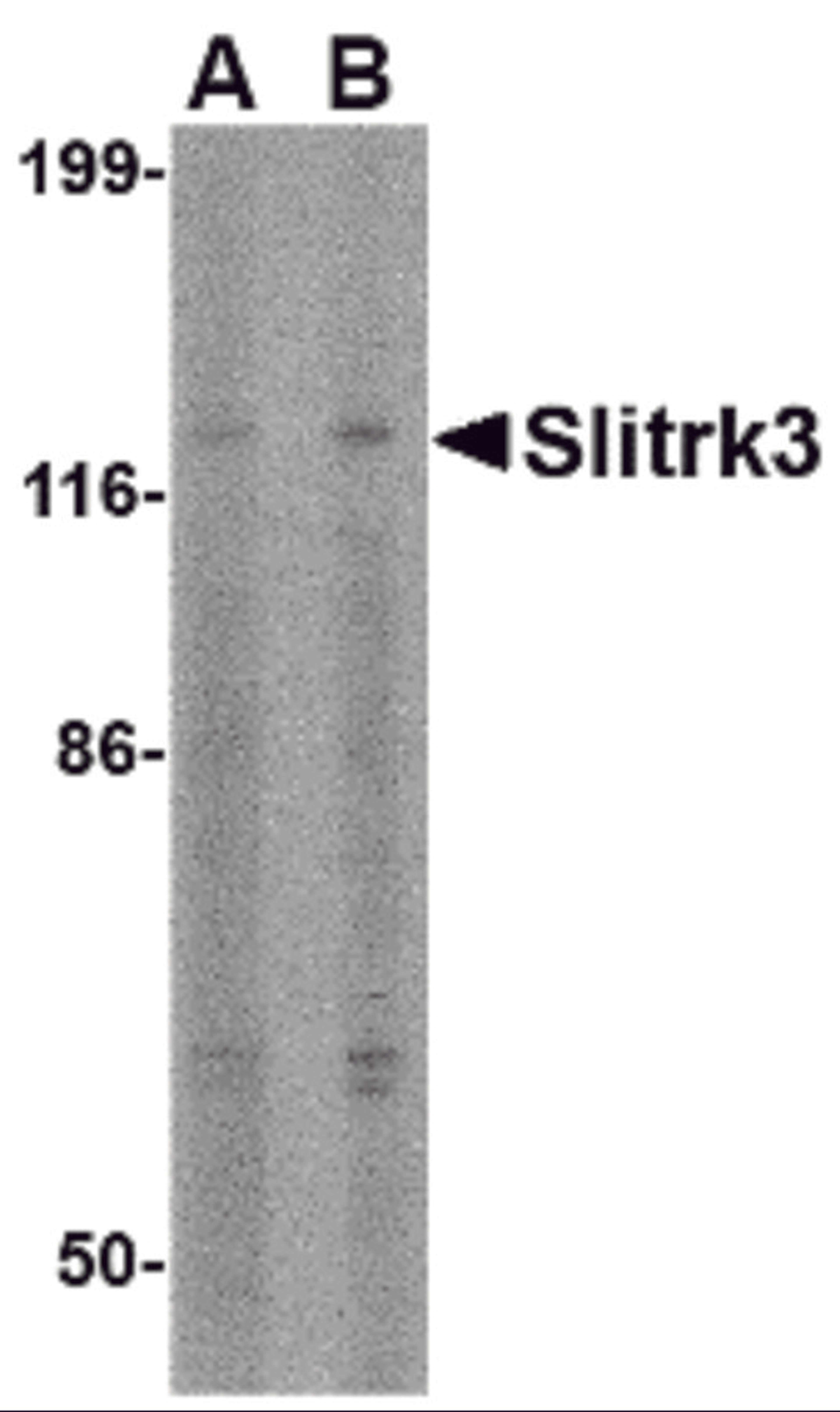 Western blot analysis of Slitrk3 in SK-N-SH cell lysate with Slitrk3 antibody at (A) 0.5 and (B) 1 μg/mL.