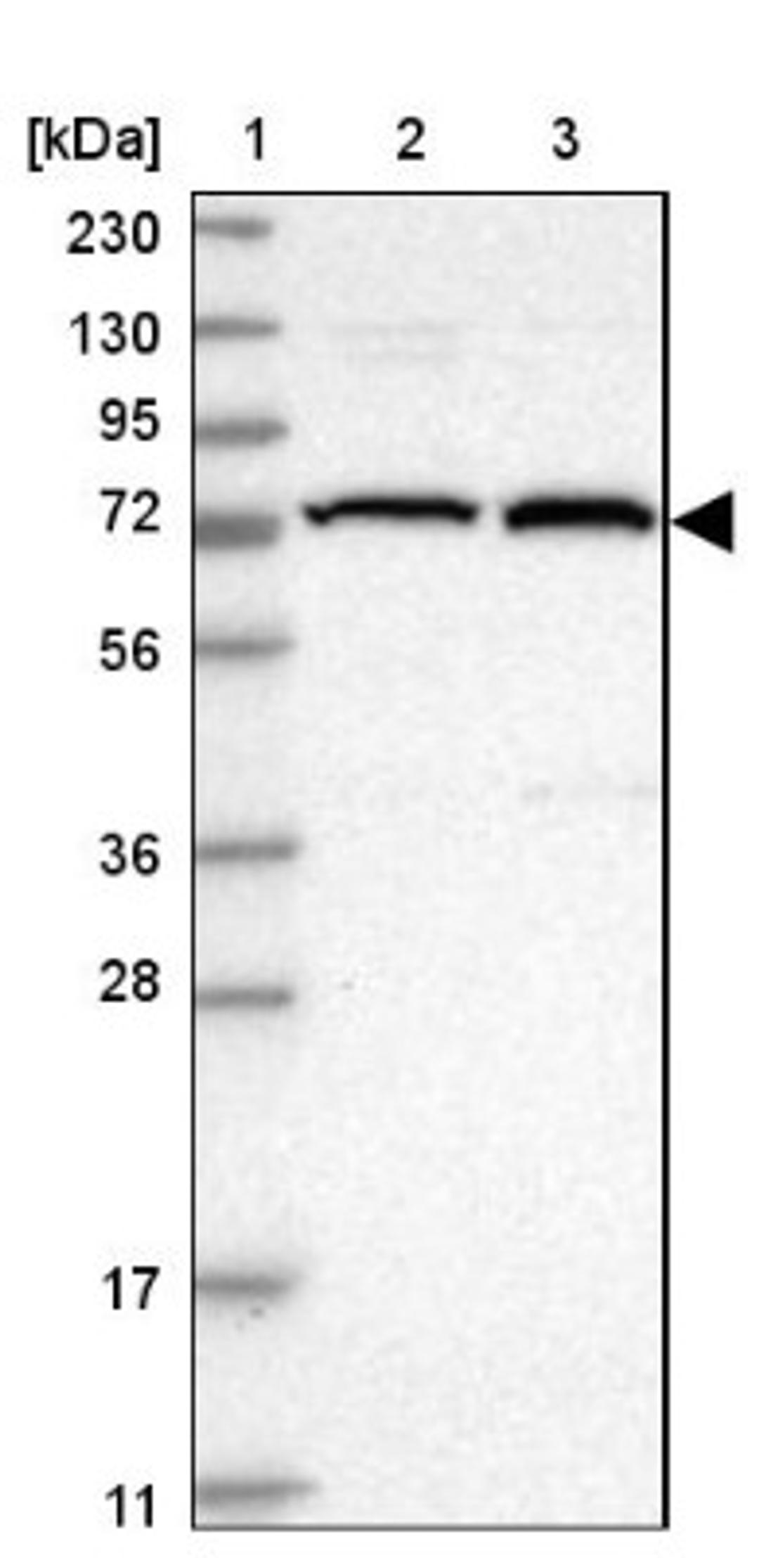 Western Blot: KIFC3 Antibody [NBP1-86021] - Lane 1: Marker [kDa] 230, 130, 95, 72, 56, 36, 28, 17, 11<br/>Lane 2: Human cell line RT-4<br/>Lane 3: Human cell line U-251MG sp