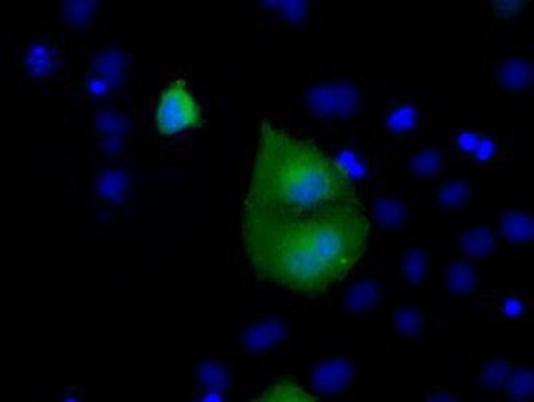 Immunocytochemistry/Immunofluorescence: Rab17 Antibody (5E2) [NBP2-02599] Staining of COS7 cells transiently transfected by pCMV6-ENTRY Rab17.