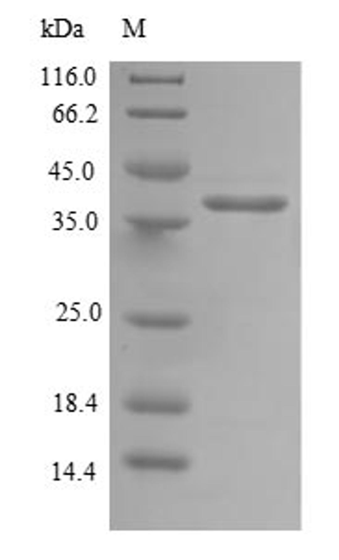 (Tris-Glycine gel) Discontinuous SDS-PAGE (reduced) with 5% enrichment gel and 15% separation gel.