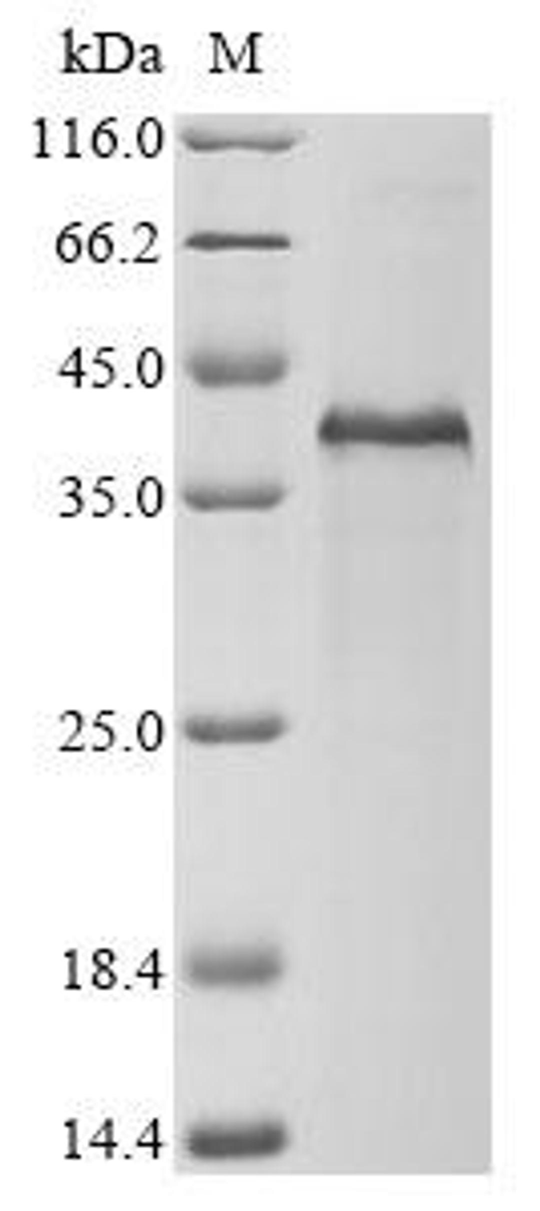 (Tris-Glycine gel) Discontinuous SDS-PAGE (reduced) with 5% enrichment gel and 15% separation gel.