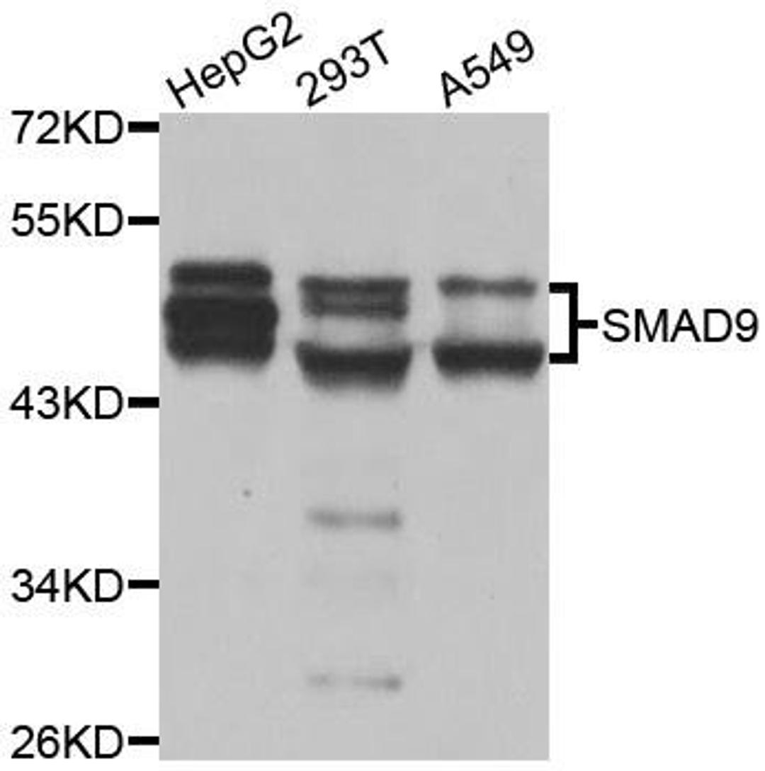 Western blot analysis of extracts of various cell lines using SMAD9 antibody