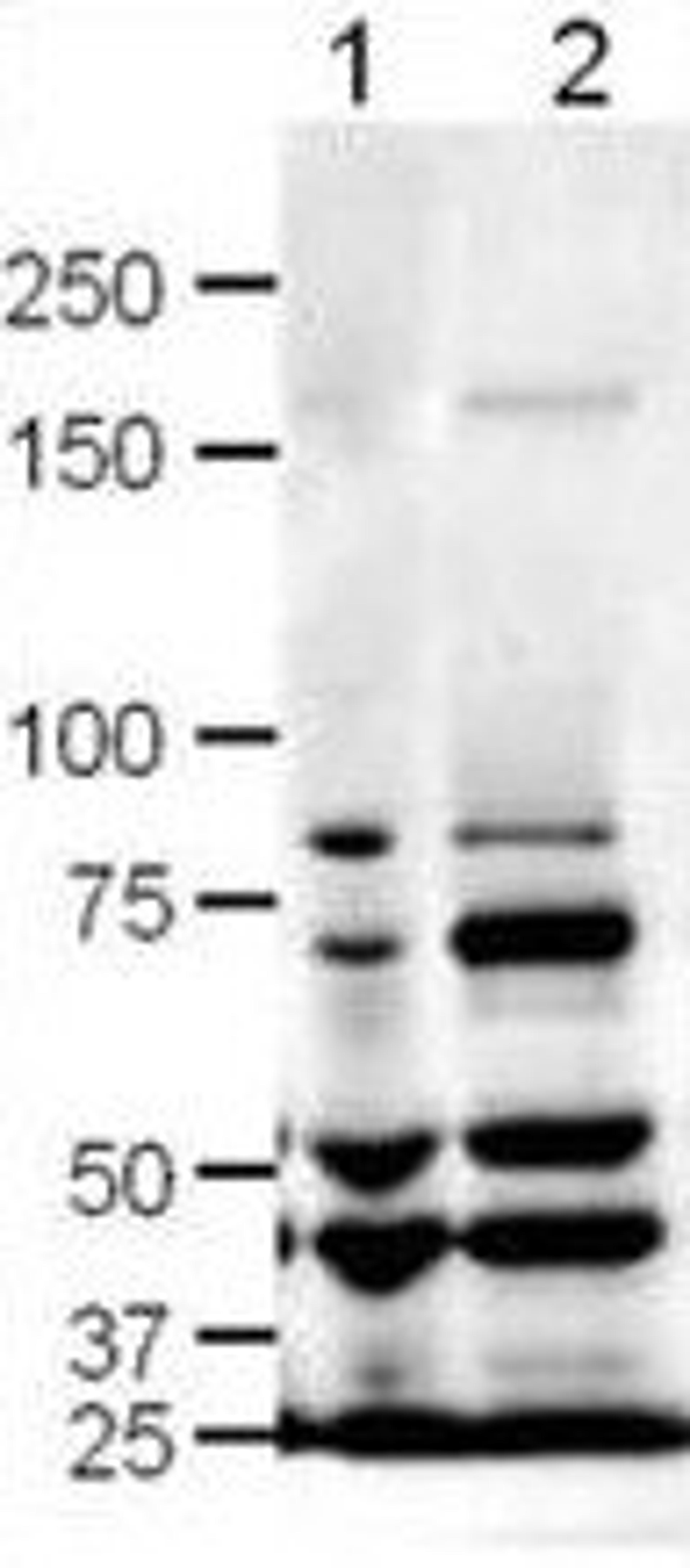 Western blot analysis of rat (lane 1) and mouse (lane 2) brain lysates using SLIT-1 antibody