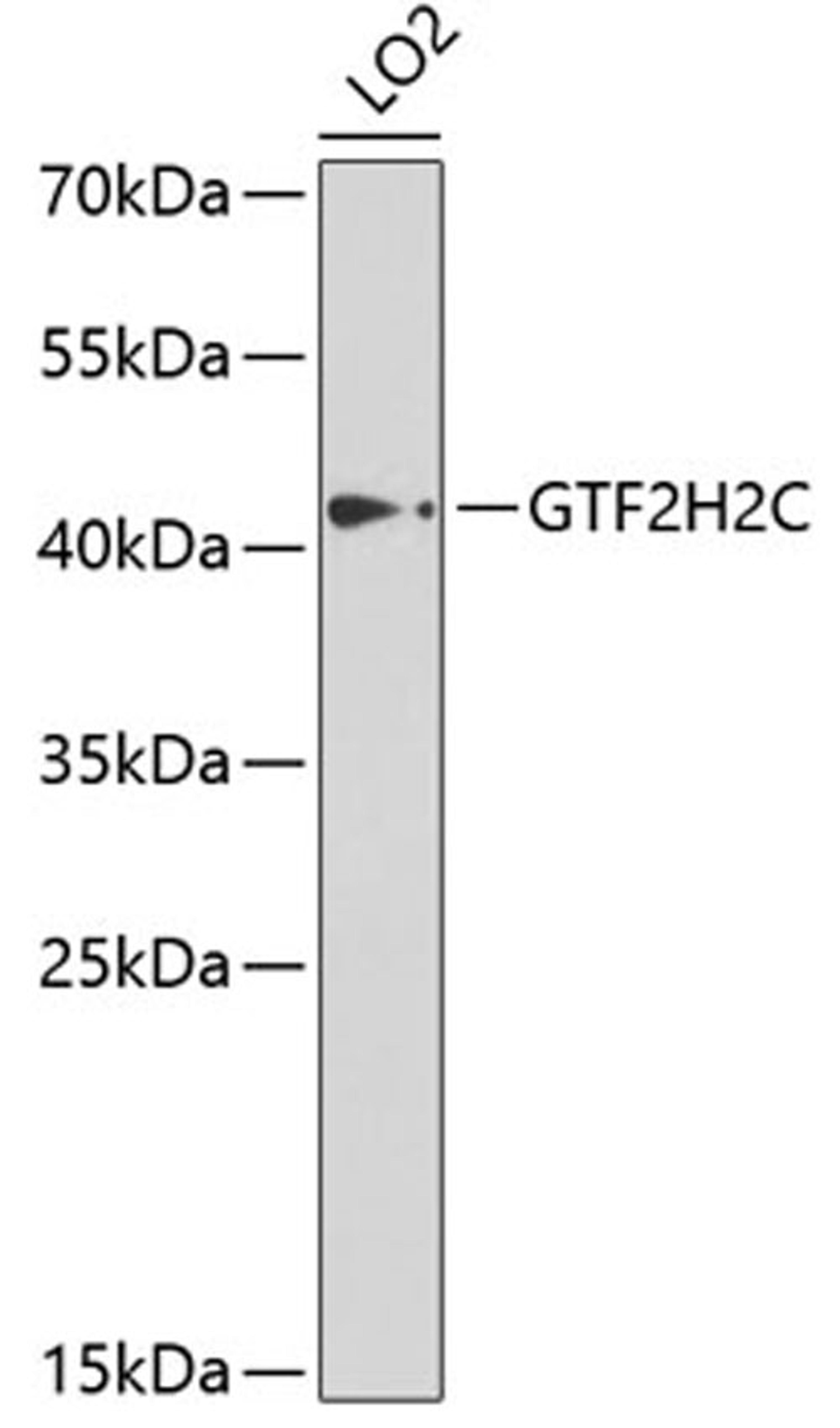 Western blot - GTF2H2C antibody (A5239)