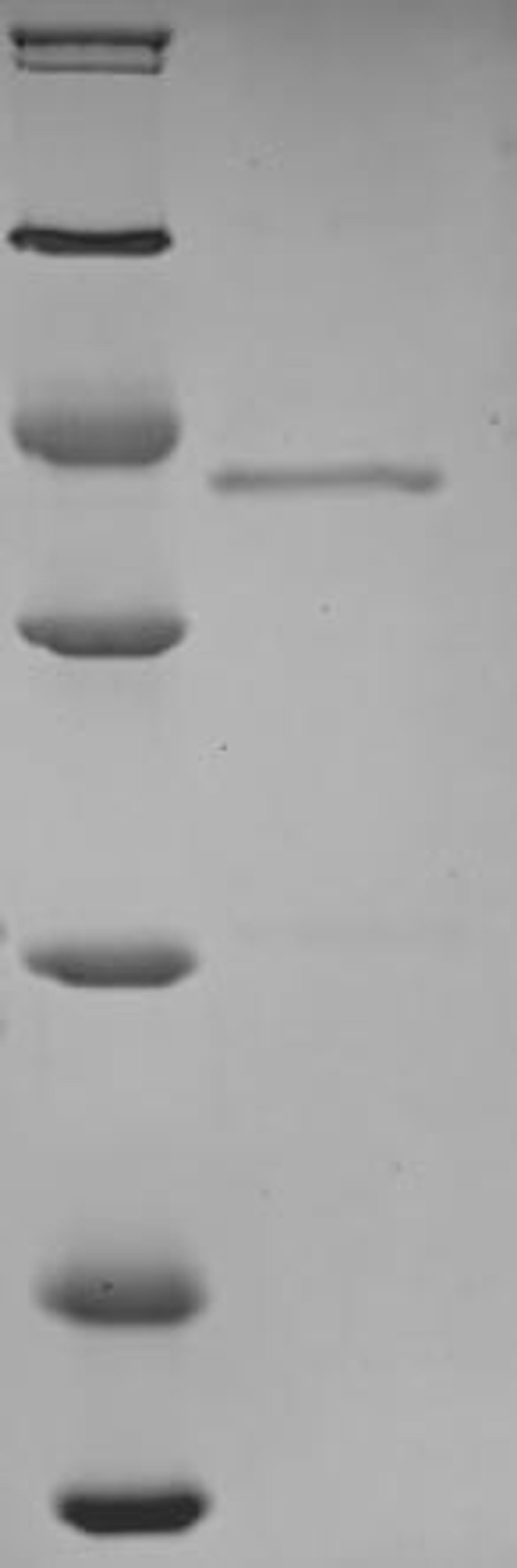 (Tris-Glycine gel) Discontinuous SDS-PAGE (reduced) with 5% enrichment gel and 15% separation gel.