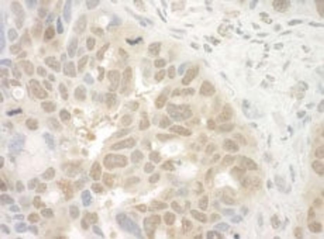 Detection of human EYA4 by immunohistochemistry.