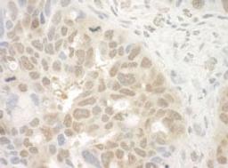 Detection of human EYA4 by immunohistochemistry.