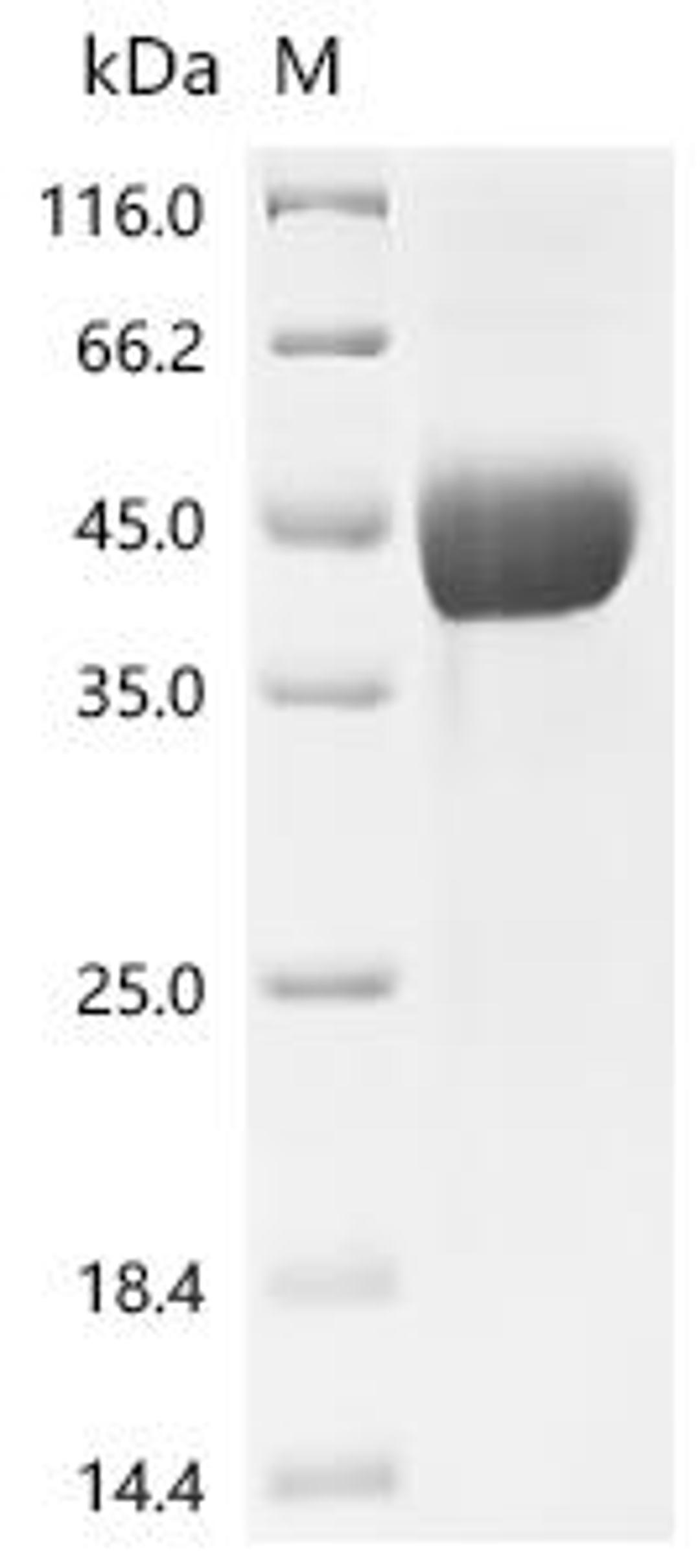 (Tris-Glycine gel) Discontinuous SDS-PAGE (reduced) with 5% enrichment gel and 15% separation gel.
