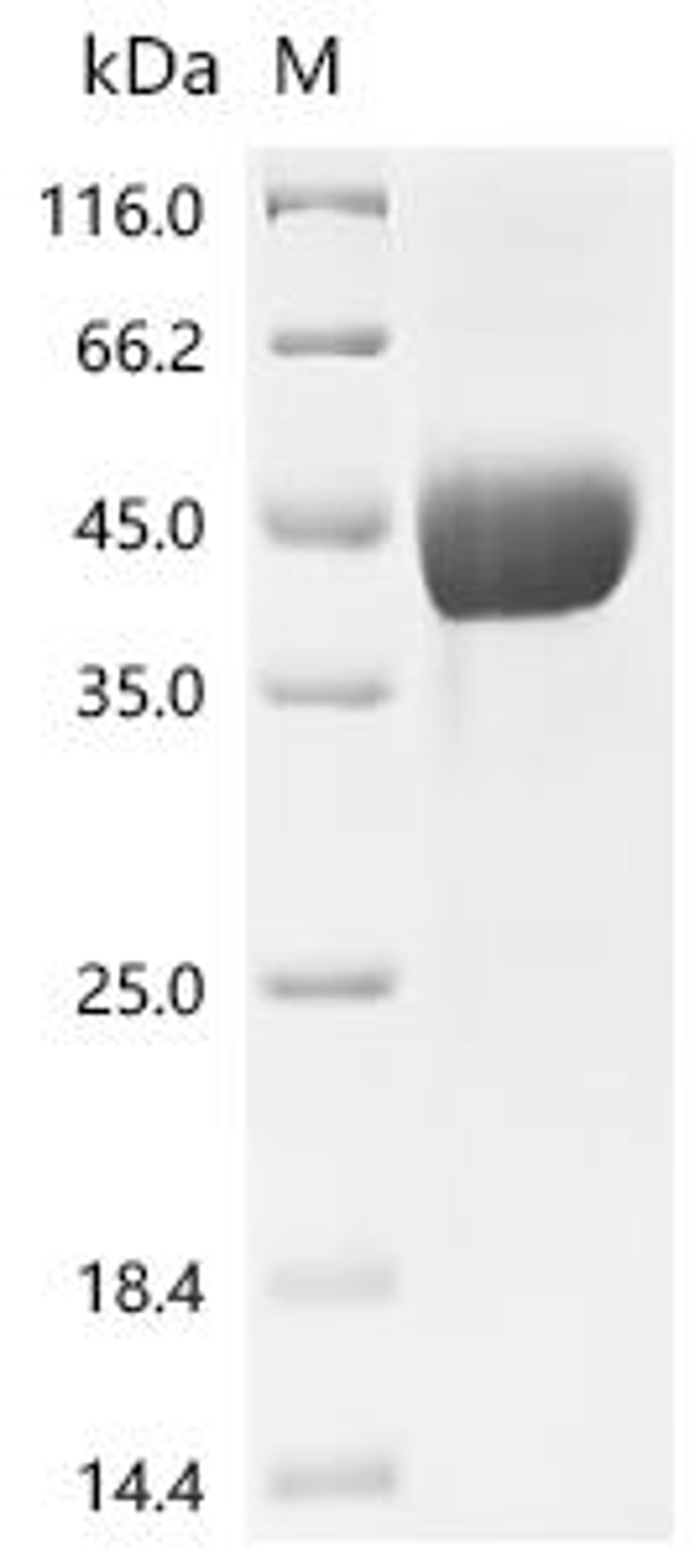 (Tris-Glycine gel) Discontinuous SDS-PAGE (reduced) with 5% enrichment gel and 15% separation gel.