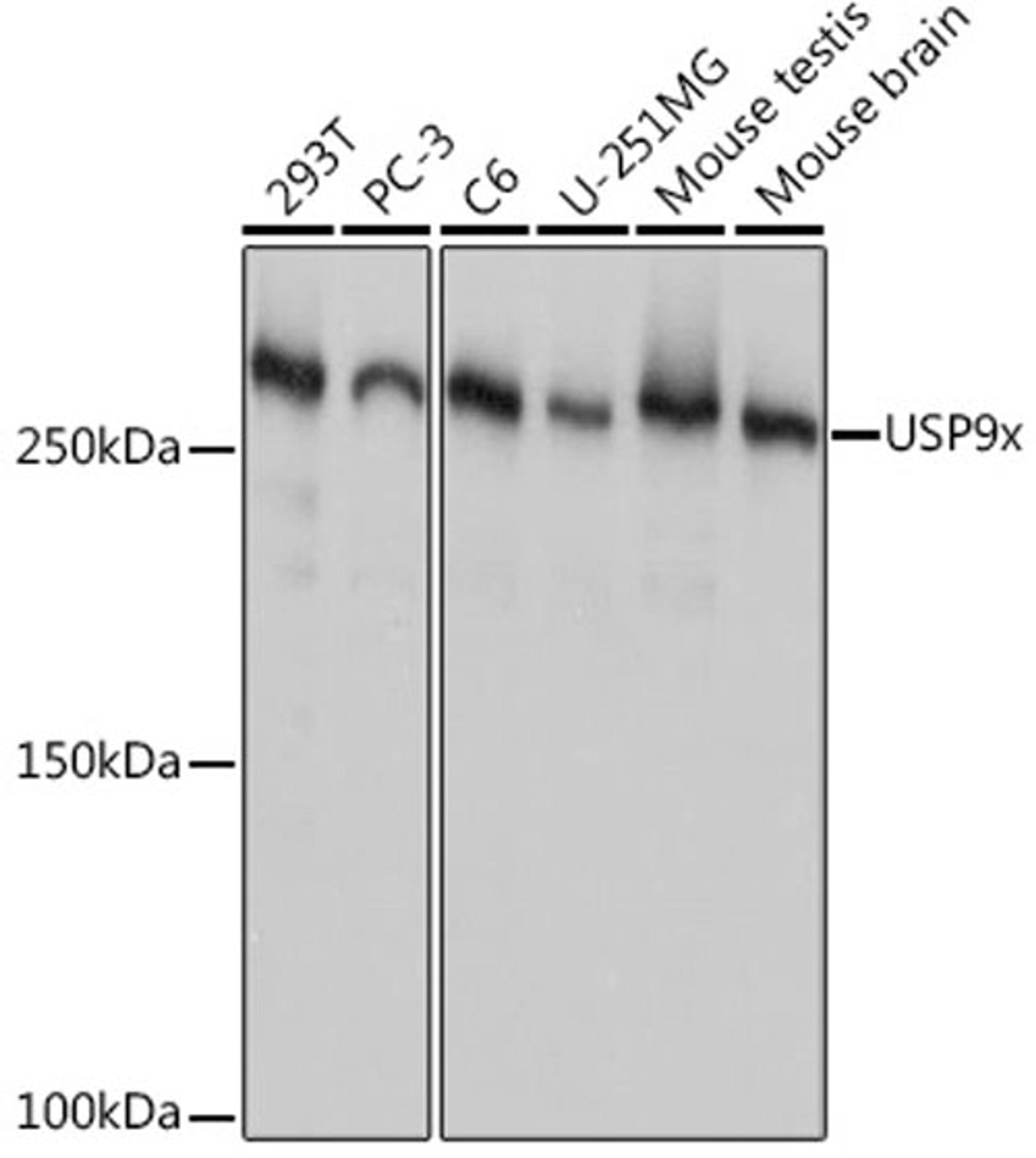 Western blot - USP9x Rabbit mAb (A9782)