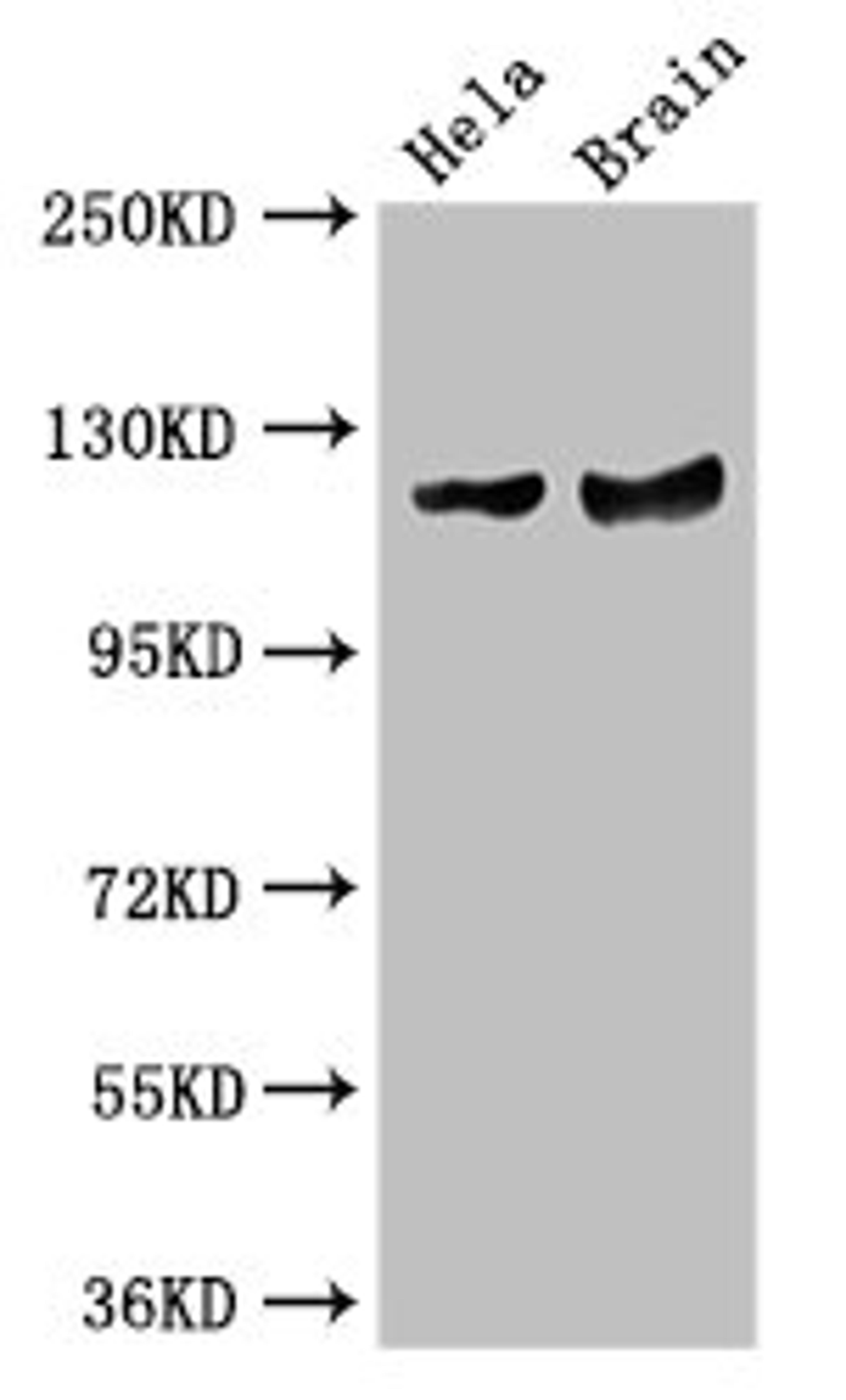 Western Blot. Positive WB detected in: Hela whole cell lysate, Mouse brain tissue. All lanes: RASA1 antibody at 3.5µg/ml. Secondary. Goat polyclonal to rabbit IgG at 1/50000 dilution. Predicted band size: 117, 101, 59, 102 kDa. Observed band size: 117 kDa