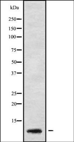 Western blot analysis of HeLa whole cell lysates using GNG5 antibody