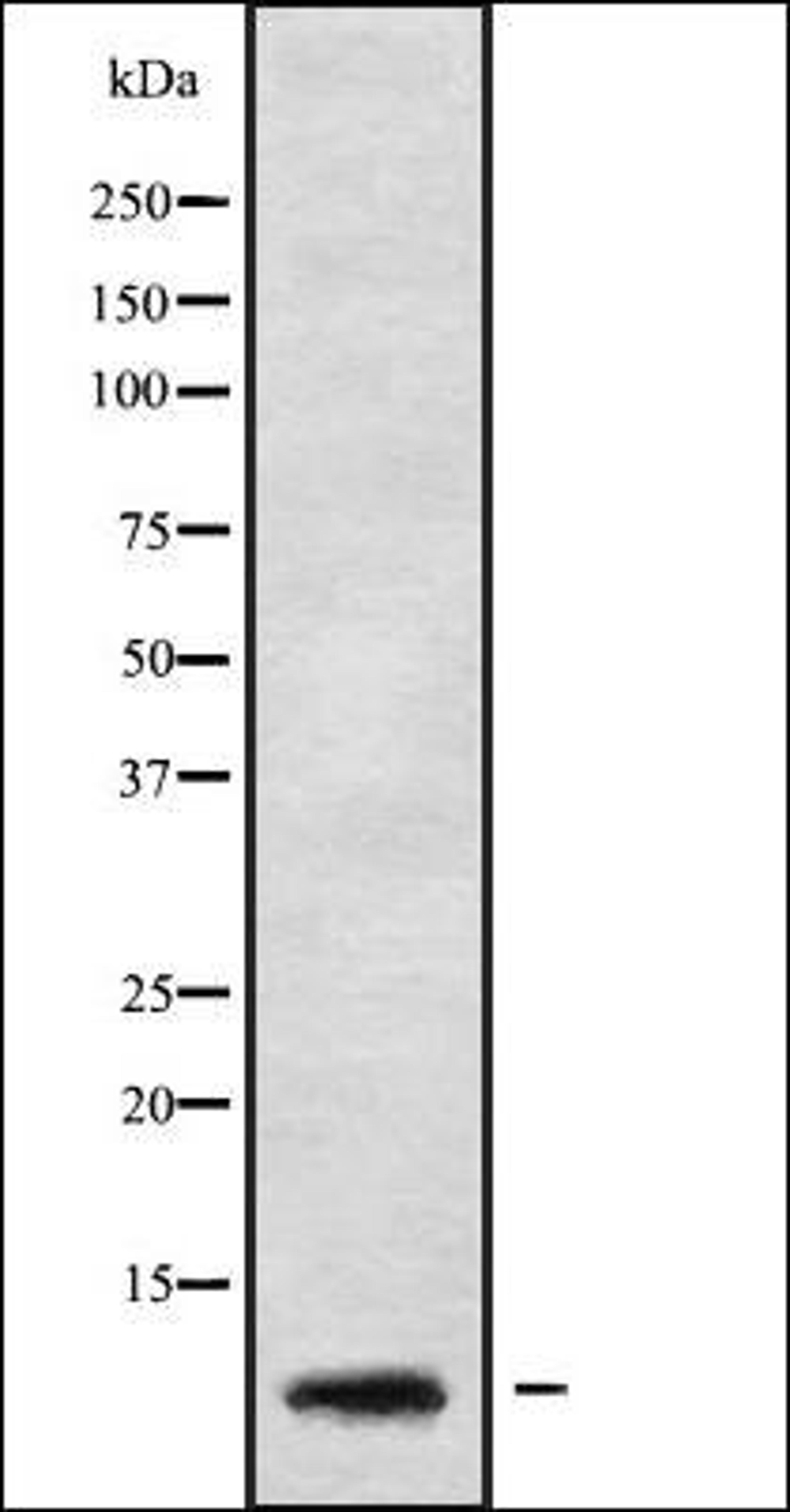 Western blot analysis of HeLa whole cell lysates using GNG5 antibody