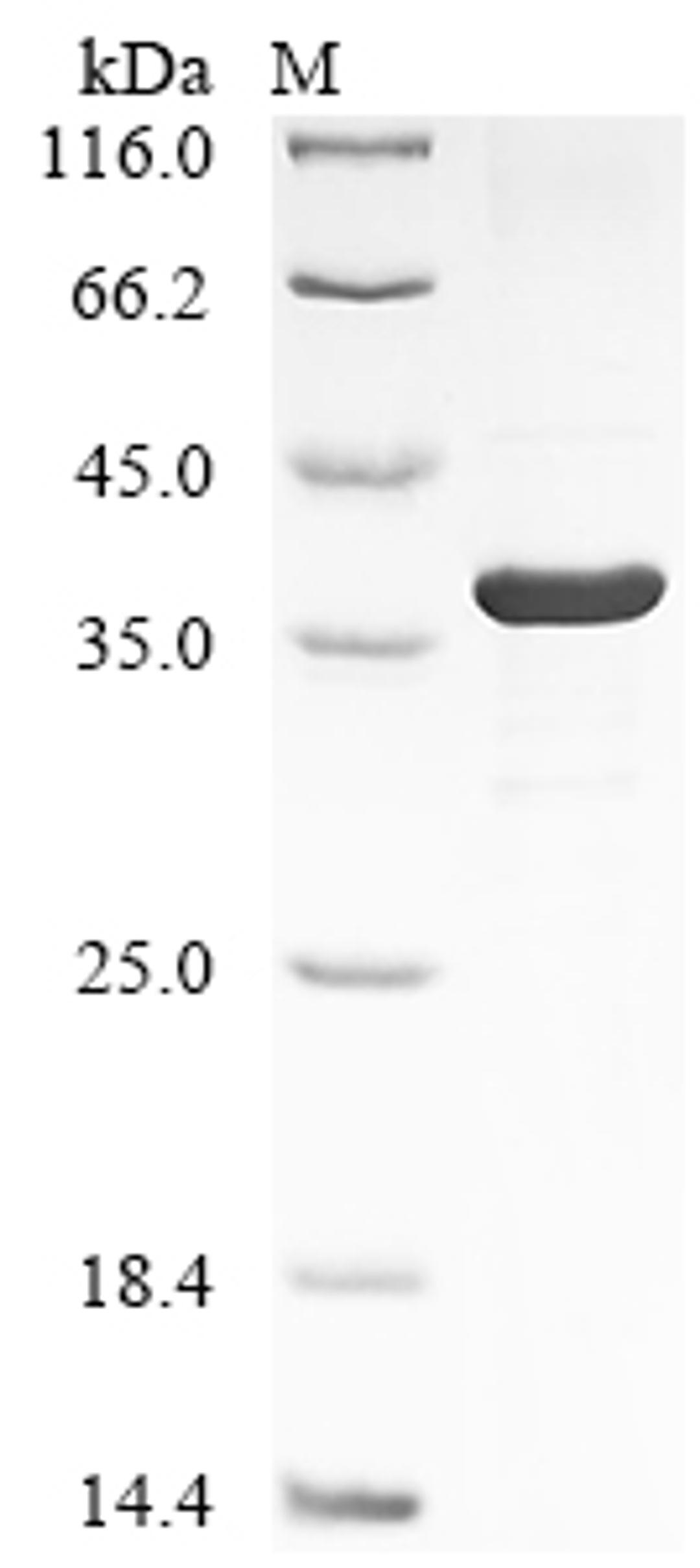 (Tris-Glycine gel) Discontinuous SDS-PAGE (reduced) with 5% enrichment gel and 15% separation gel.