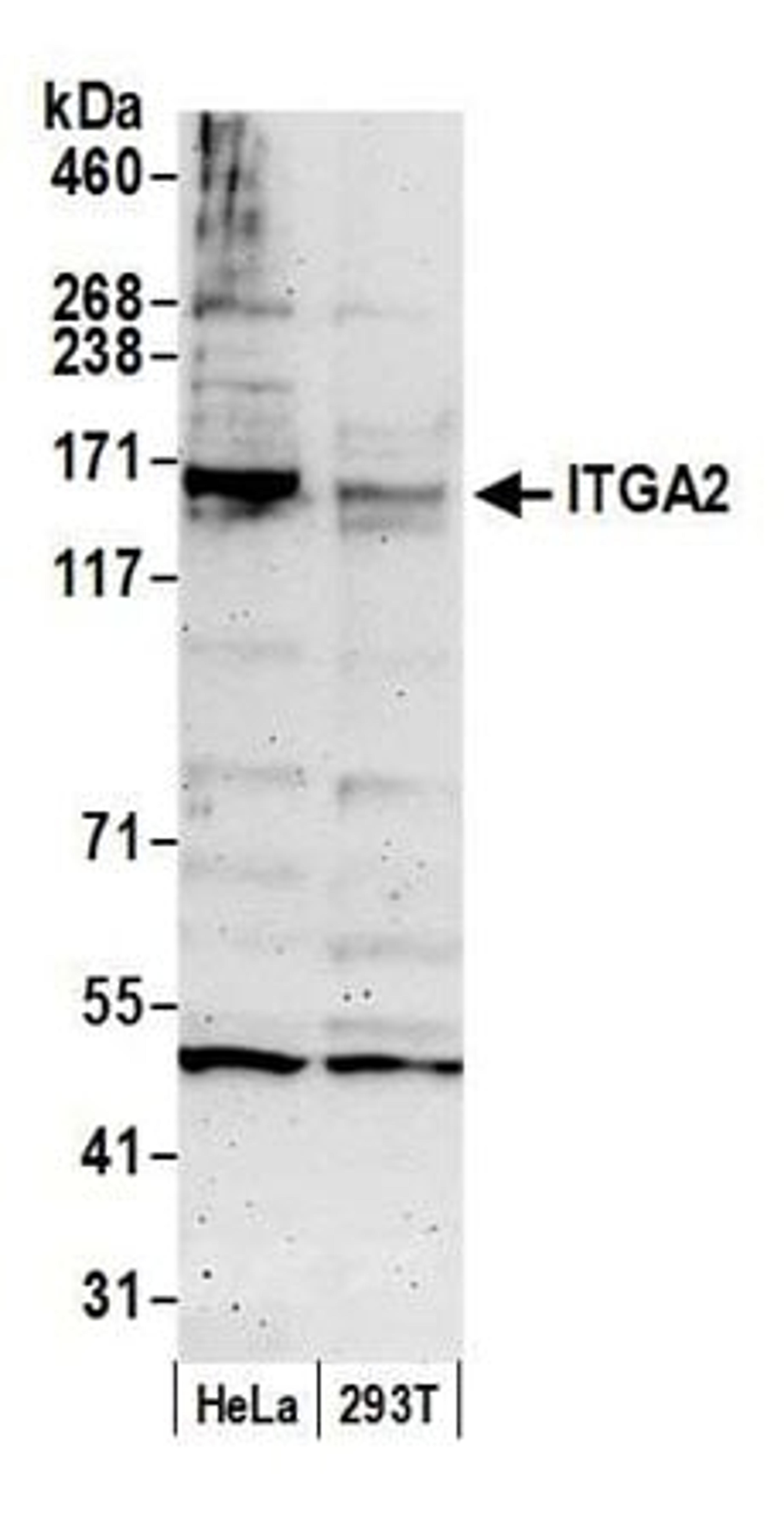 Detection of human ITGA2 by western blot.