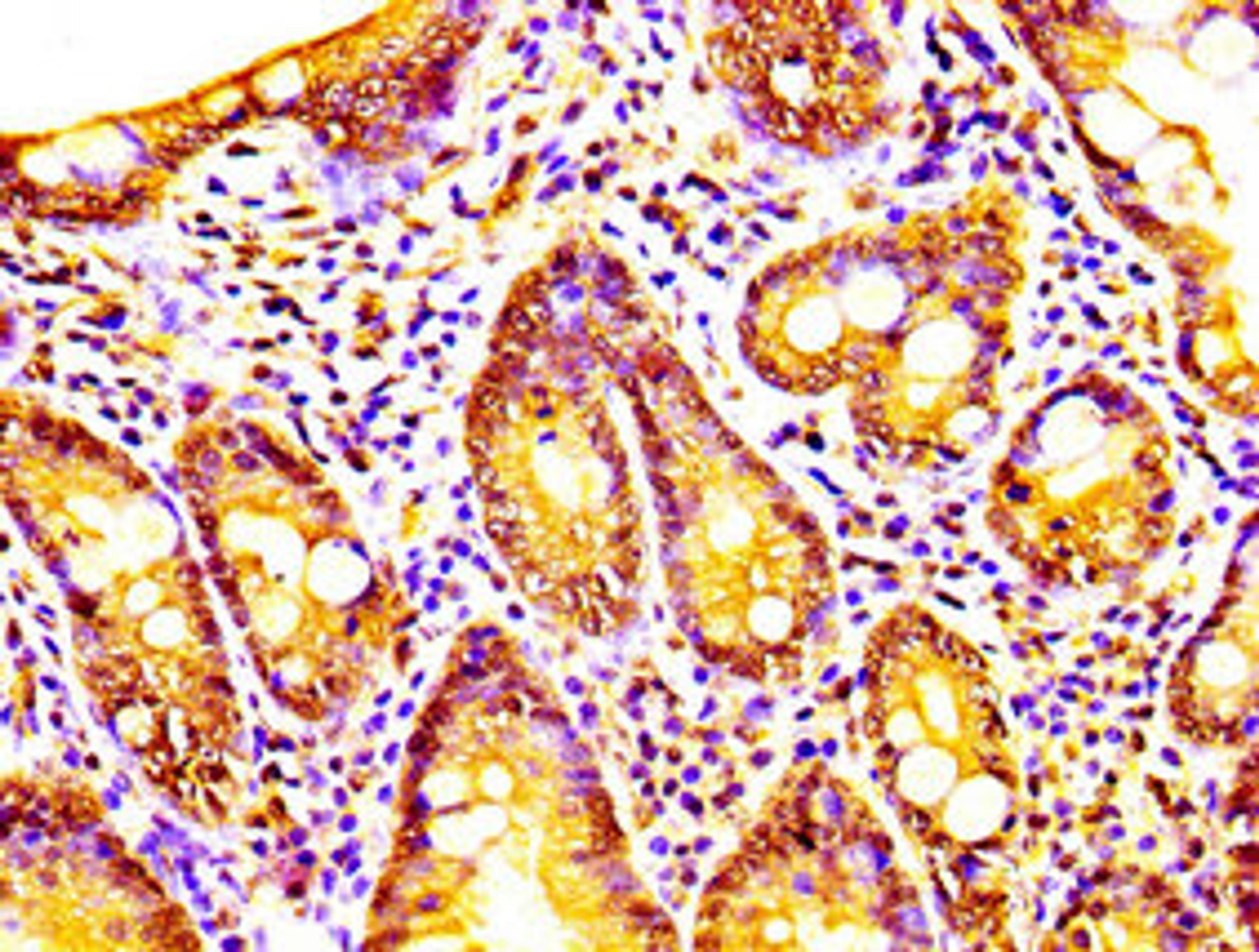 IHC image of CSB-PA614529LA01HU diluted at 1:200 and staining in paraffin-embedded human small intestine tissue performed on a Leica BondTM system. After dewaxing and hydration, antigen retrieval was mediated by high pressure in a citrate buffer (pH 6.0). Section was blocked with 10% normal goat serum 30min at RT. Then primary antibody (1% BSA) was incubated at 4&deg;C overnight. The primary is detected by a biotinylated secondary antibody and visualized using an HRP conjugated SP system.